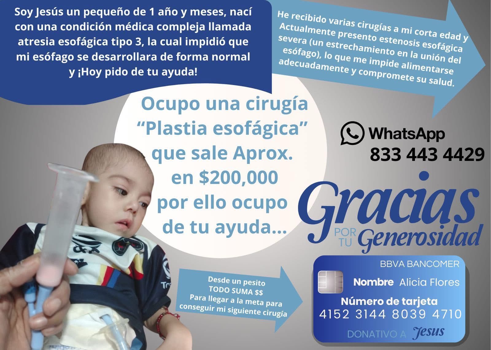 Child in urgent need of life-saving esophageal surgery campaign photo, 2 of 5