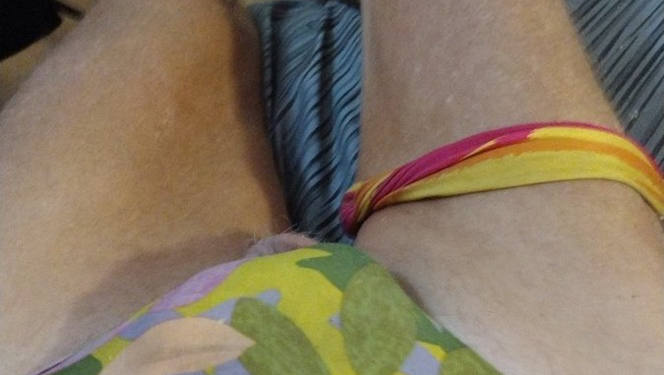 Help Reno Walk Again from Los Angeles photo