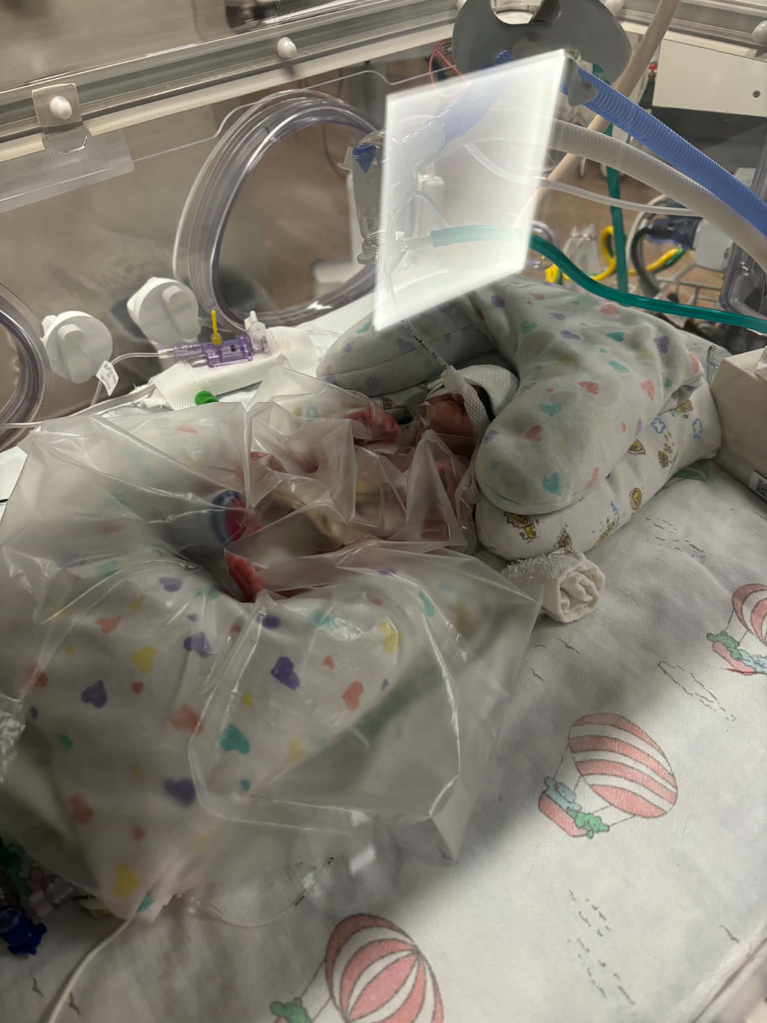AFTER 279 DAYS IN THE NICU… ZACHARIAH IS FINALLY COMING HOME campaign photo, 5 of 6