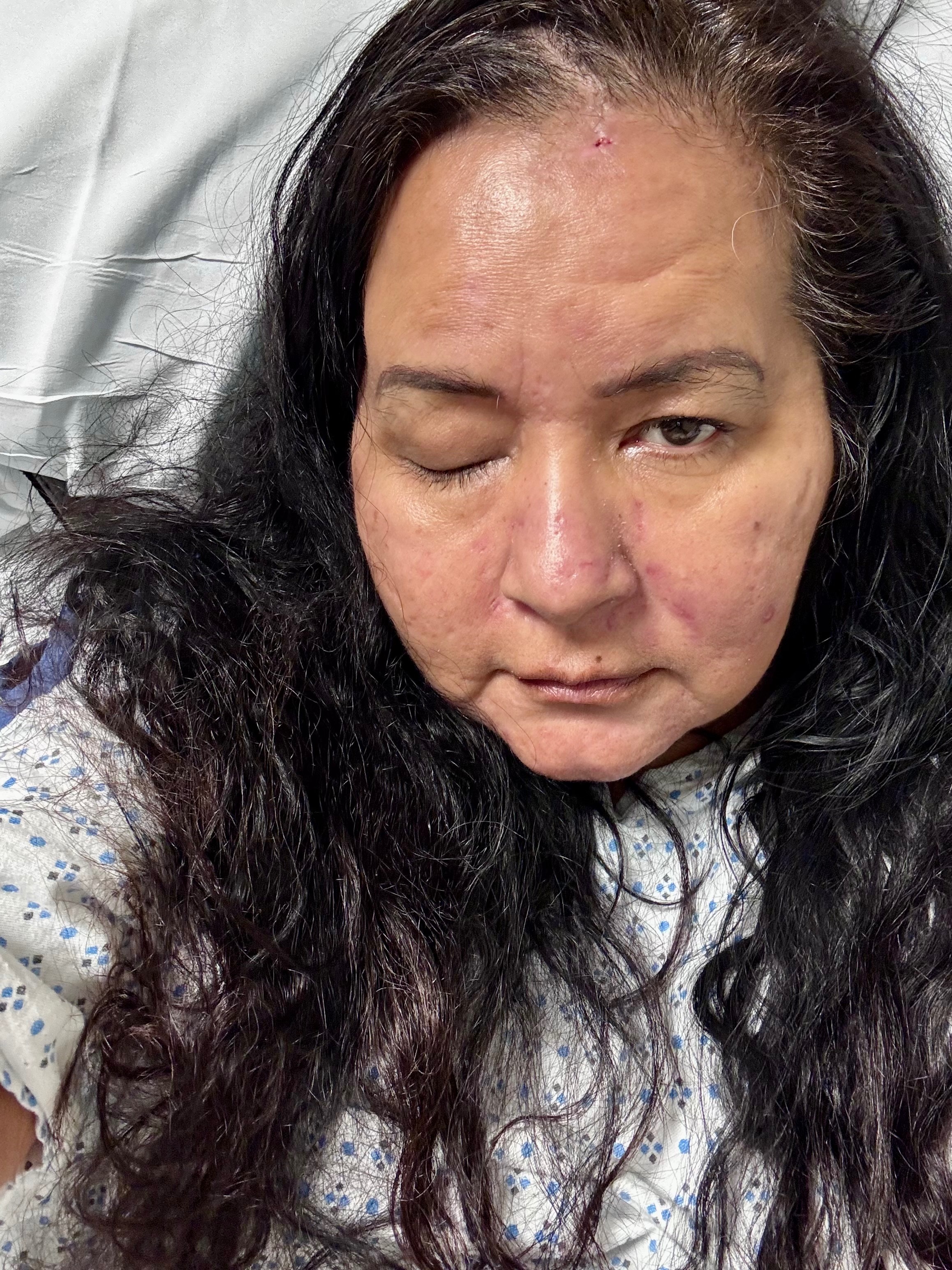 Help Our Mom Rebuild After Brain Surgery campaign photo, 4 of 5