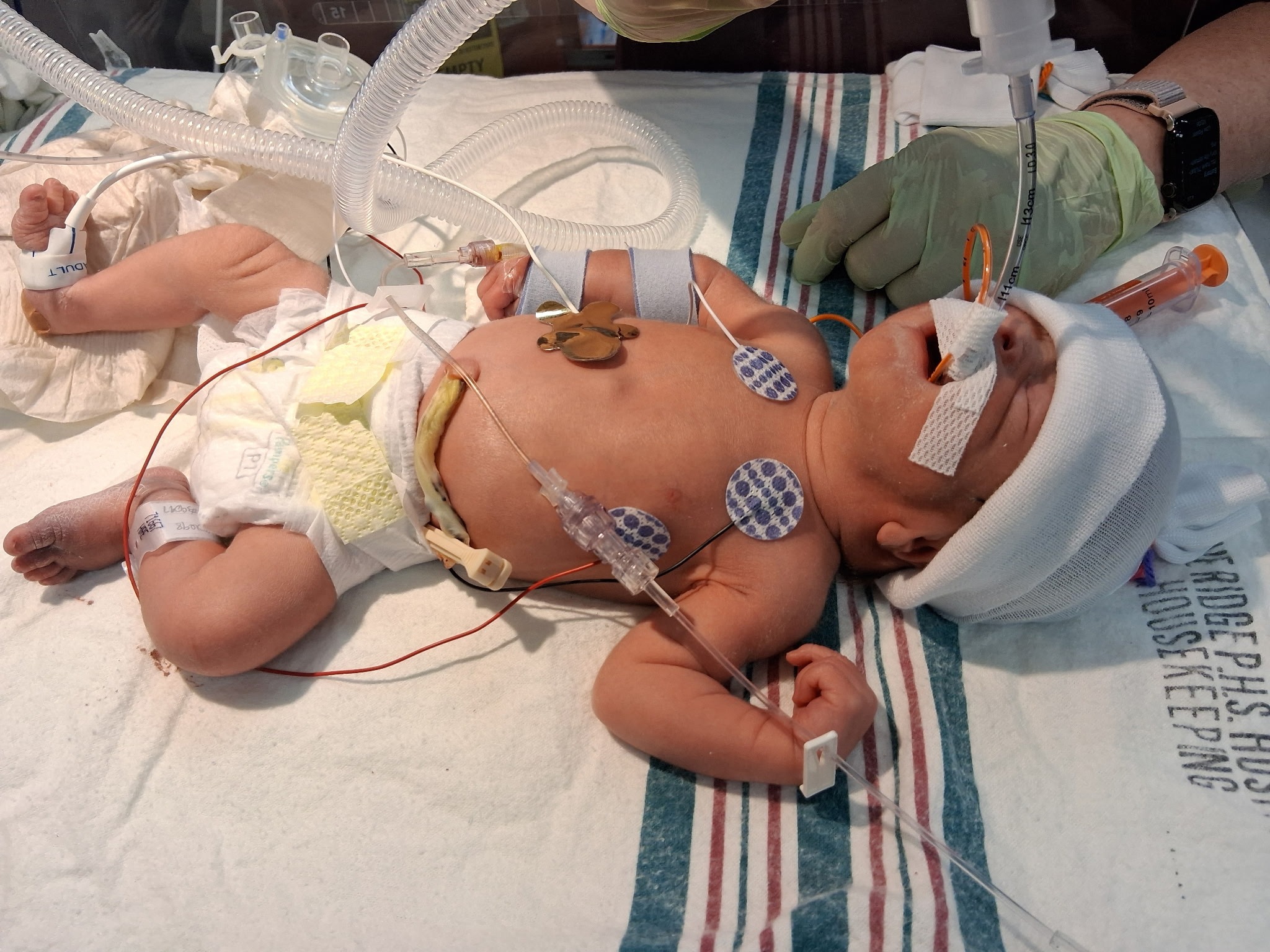 Help Us Stay With Teresa Ann in the NICU campaign photo, 4 of 8
