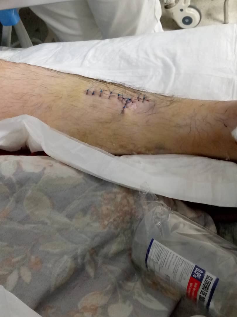 Help Kevin Acacio’s Surgery - Ayuda a Kevin campaign photo, 6 of 7