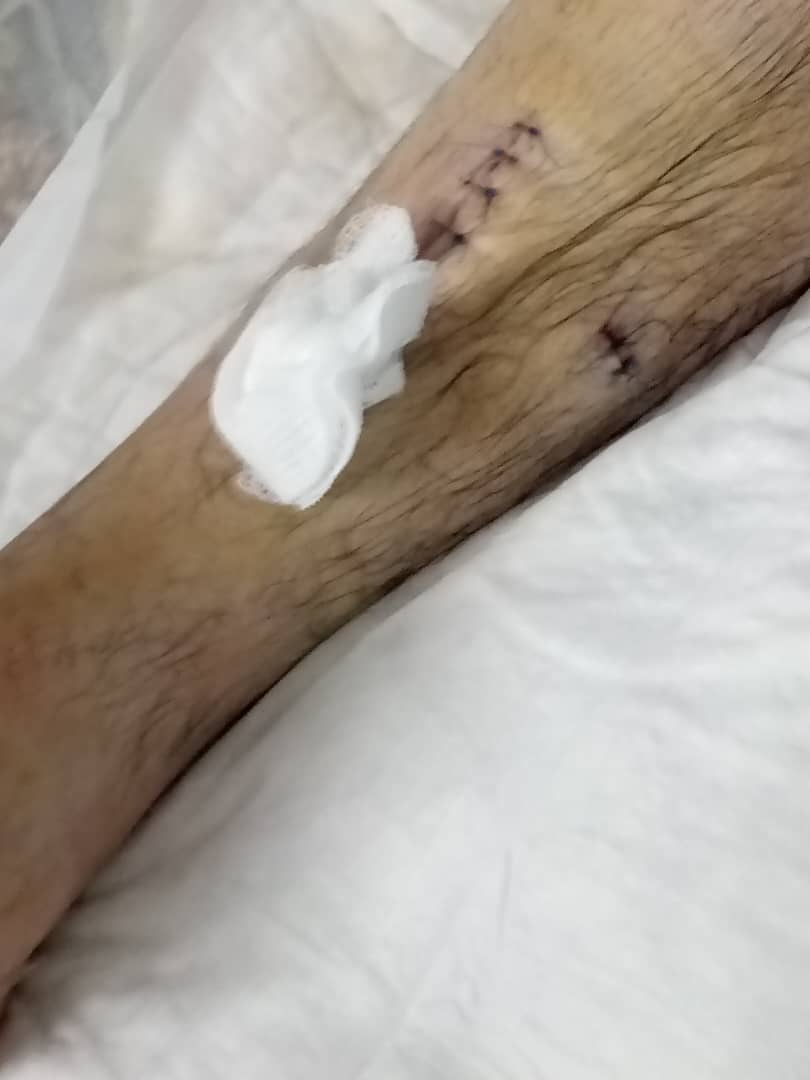 Help Kevin Acacio’s Surgery - Ayuda a Kevin campaign photo, 4 of 7