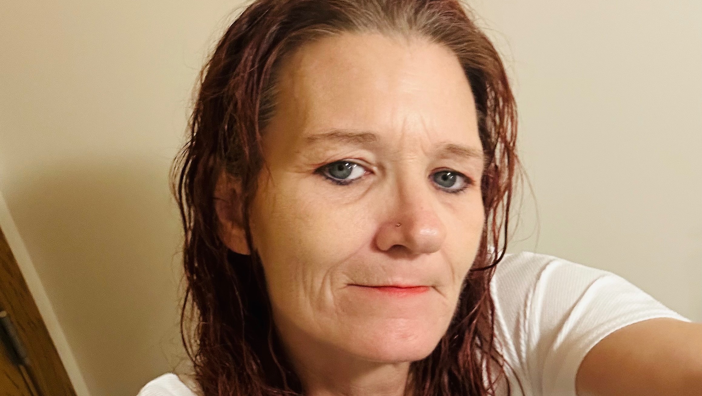 Support Kerry Through Aplastic Anemia photo