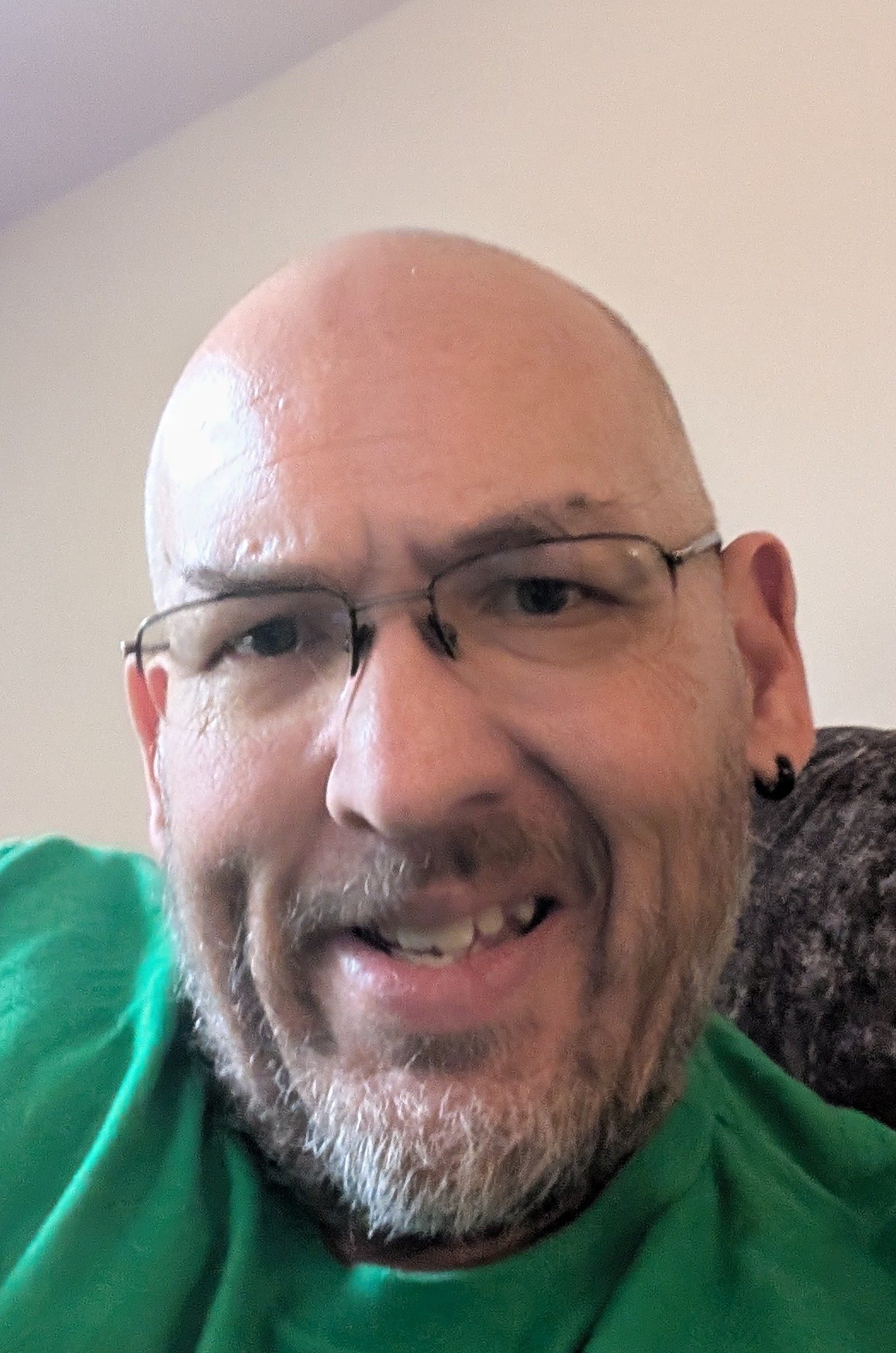 Support My Journey Through Brain Surgery campaign photo, 4 of 5