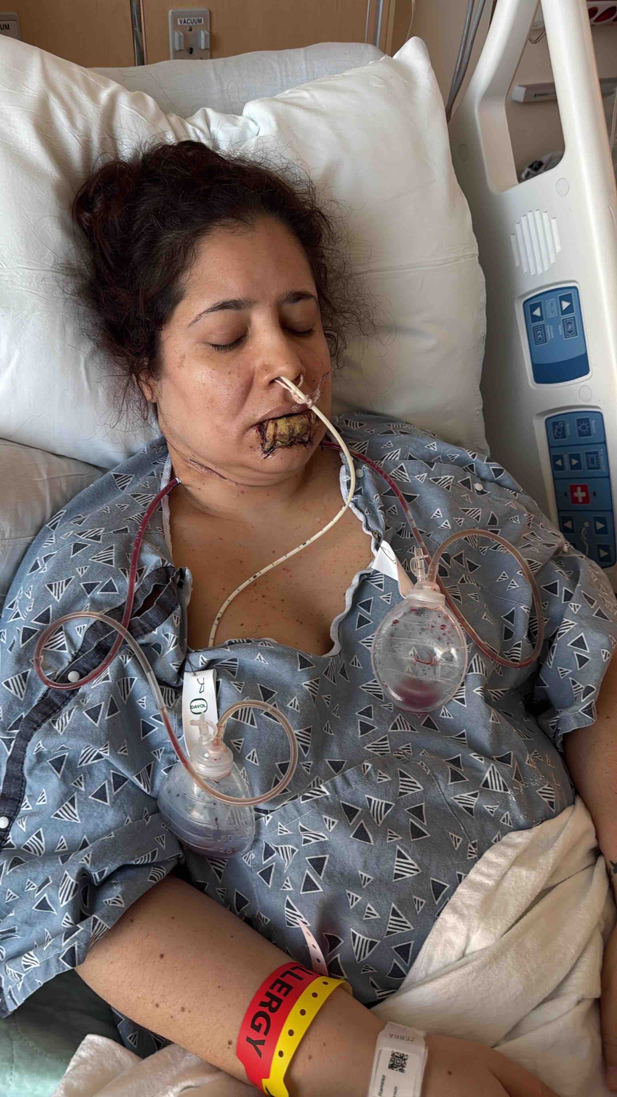 Help Uli Beat Cancer and Fund her Chemotherapy campaign photo, 7 of 8