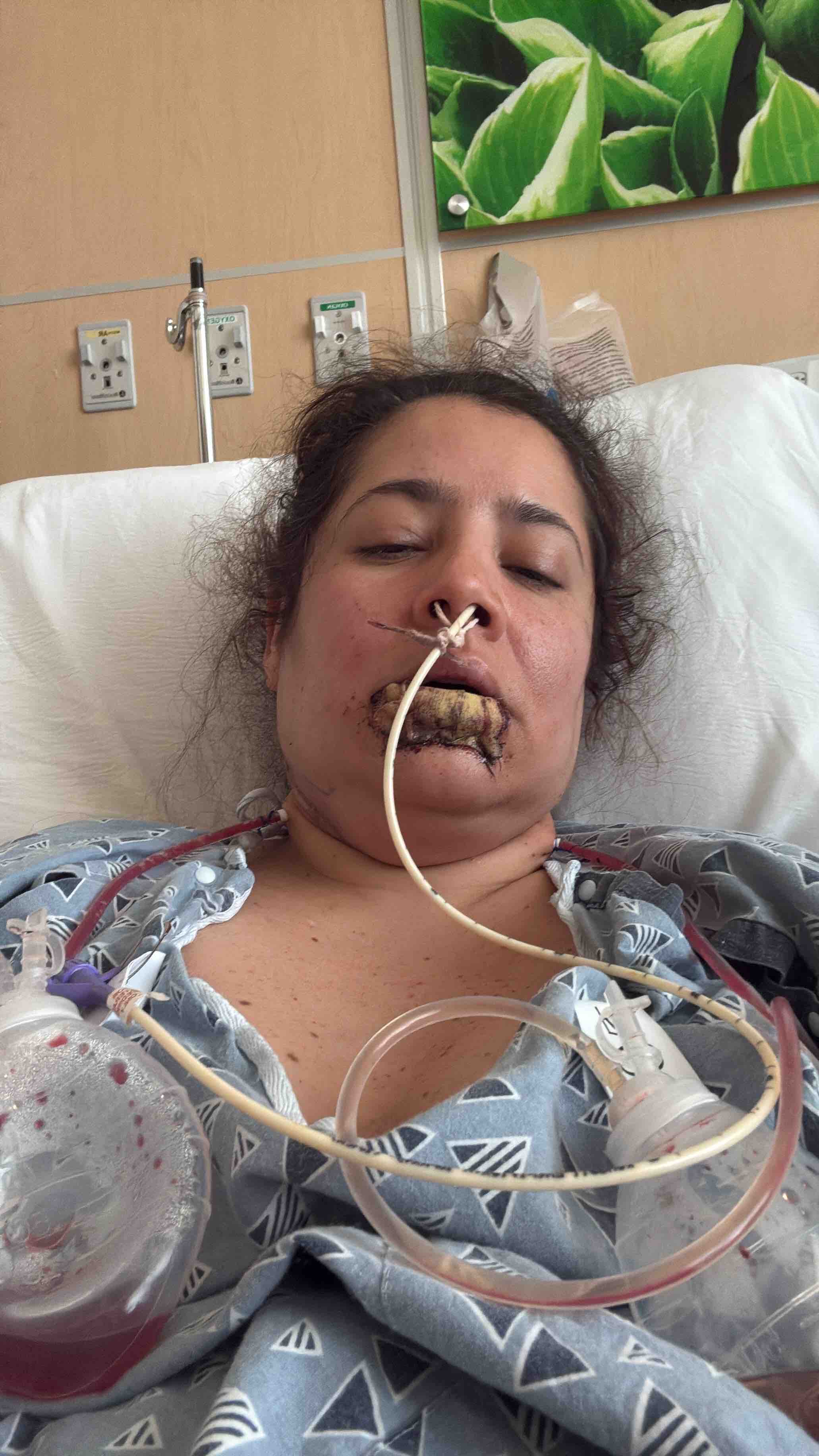 Help Uli Beat Cancer and Fund her Chemotherapy campaign photo, 2 of 8