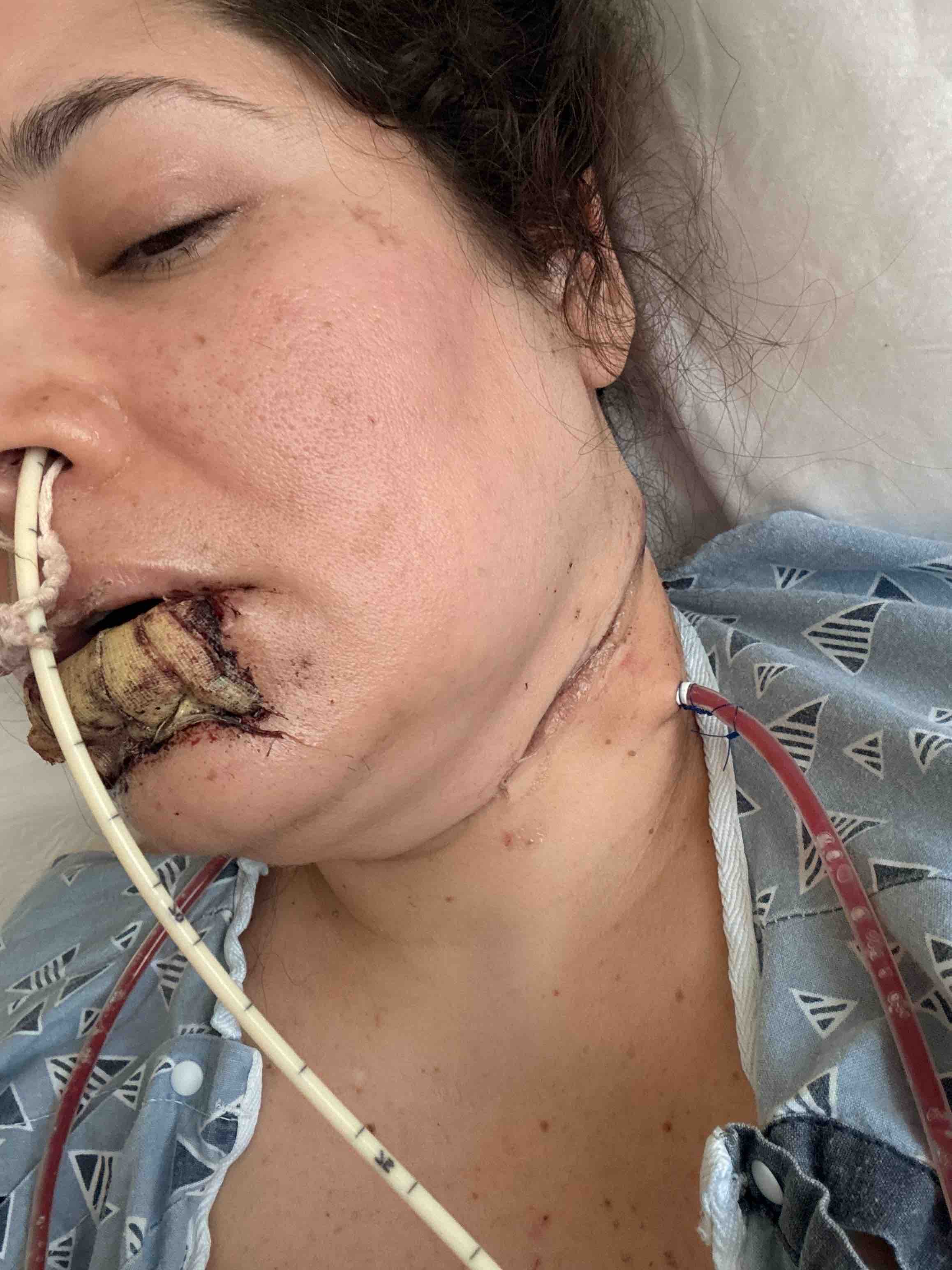 Help Uli Beat Cancer and Fund her Chemotherapy campaign photo, 5 of 8