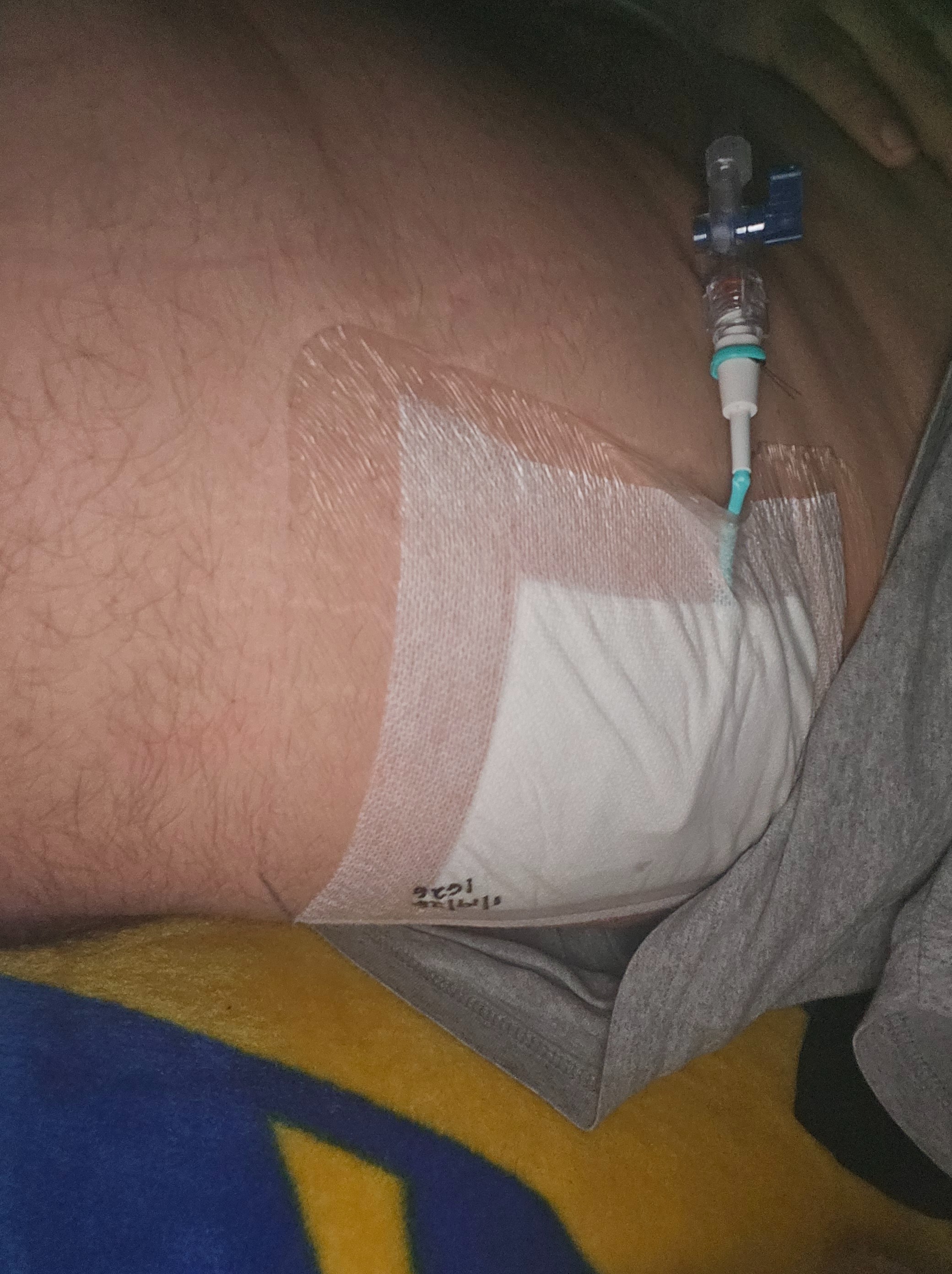 Support My Recovery After Surgery campaign photo, 2 of 6