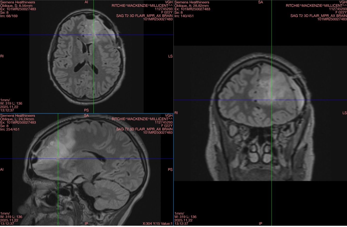 Help Mackenzie Ritchie Through Her Brain Cancer Journey campaign photo, 6 of 7
