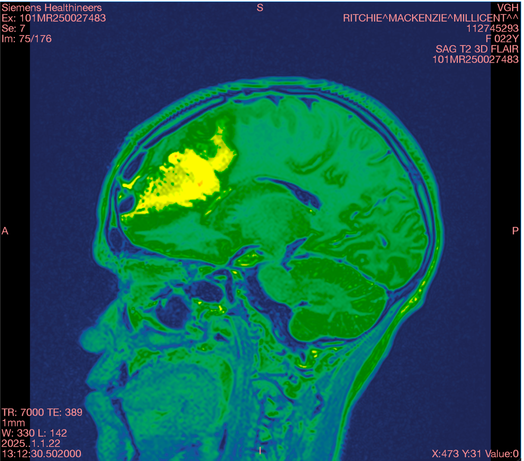Help Mackenzie Ritchie Through Her Brain Cancer Journey campaign photo, 2 of 7