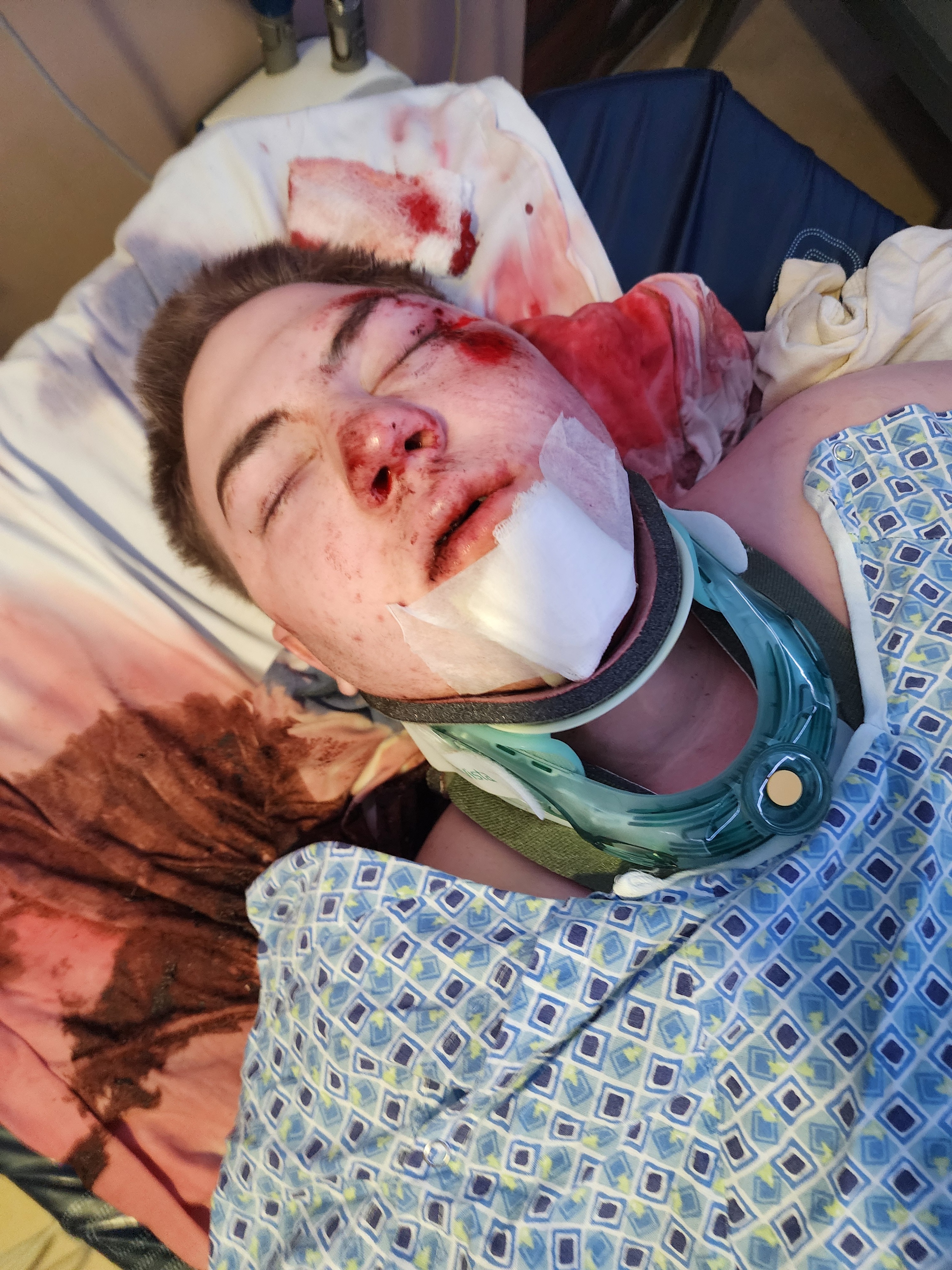 Help My Son Heal from His Severe Injuries campaign photo, 4 of 5