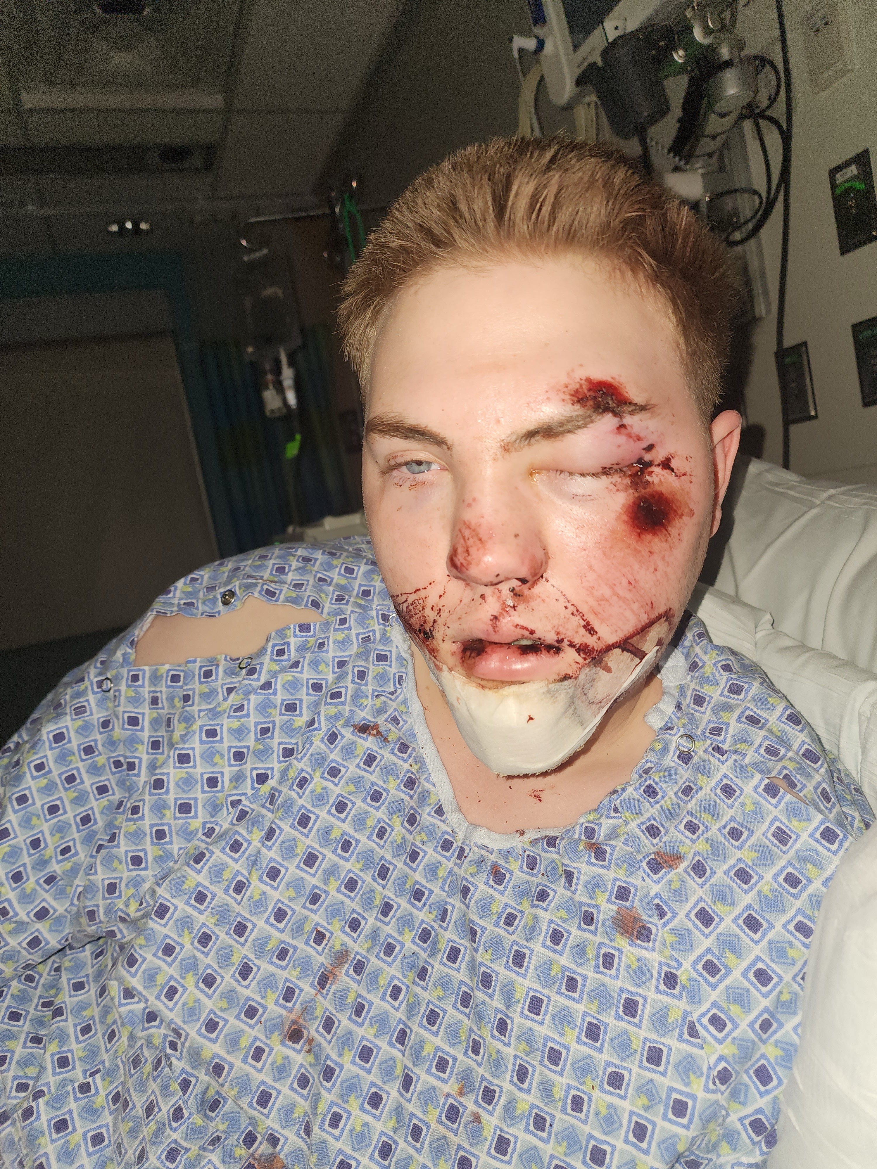 Help My Son Heal from His Severe Injuries campaign photo, 2 of 5