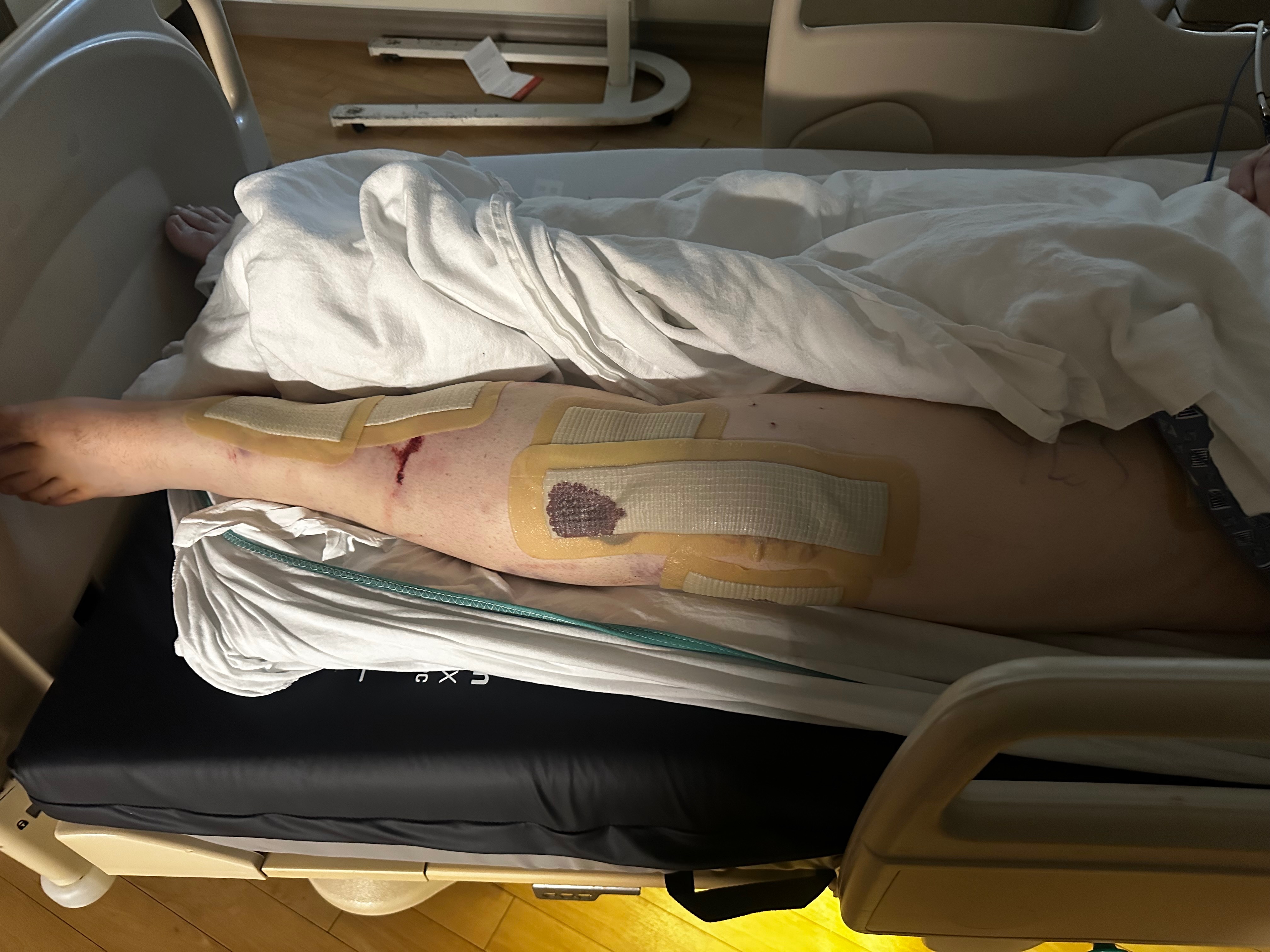 Support Damion's Recovery After His Accident campaign photo, 2 of 7