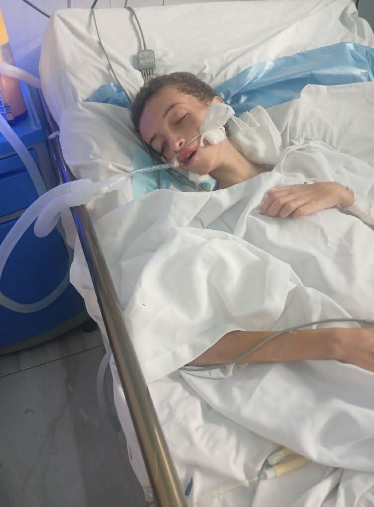 Save the future of badly injured Mohammed campaign photo, 1 of 6