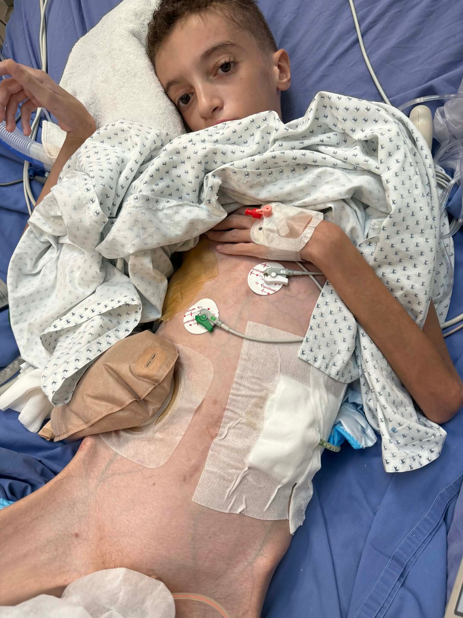 Save the future of badly injured Mohammed campaign photo, 2 of 6
