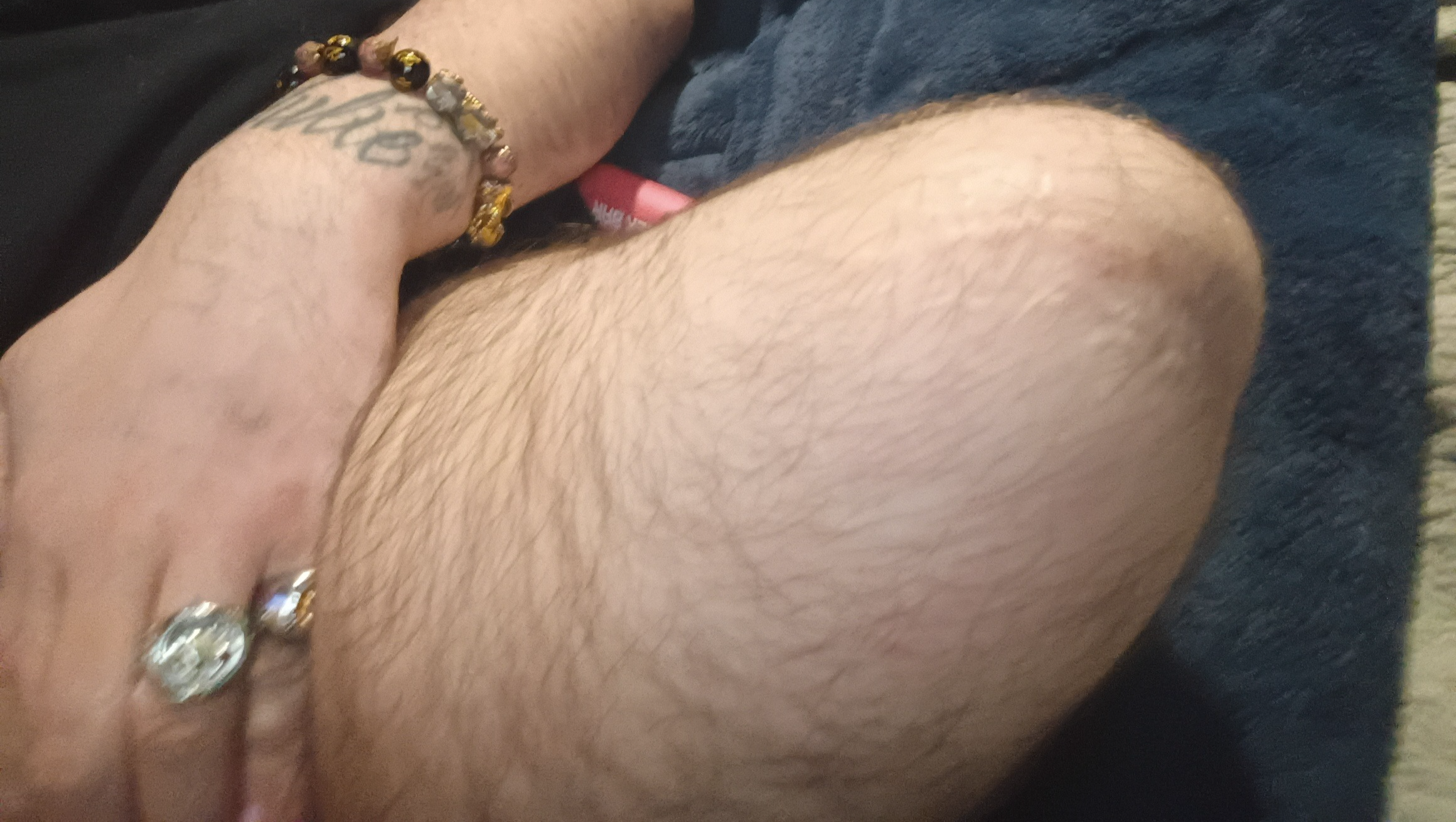 Help Michael Get a New Prosthetic Leg photo