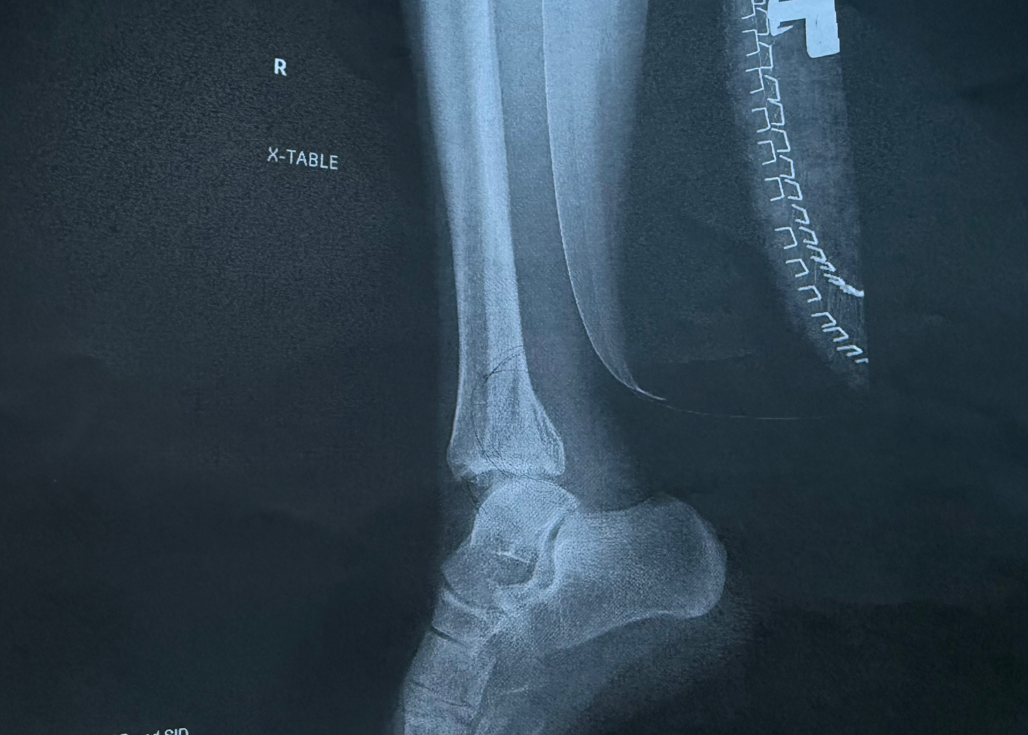Support Britnee’s Healing Journey After Surgery campaign photo, 5 of 8