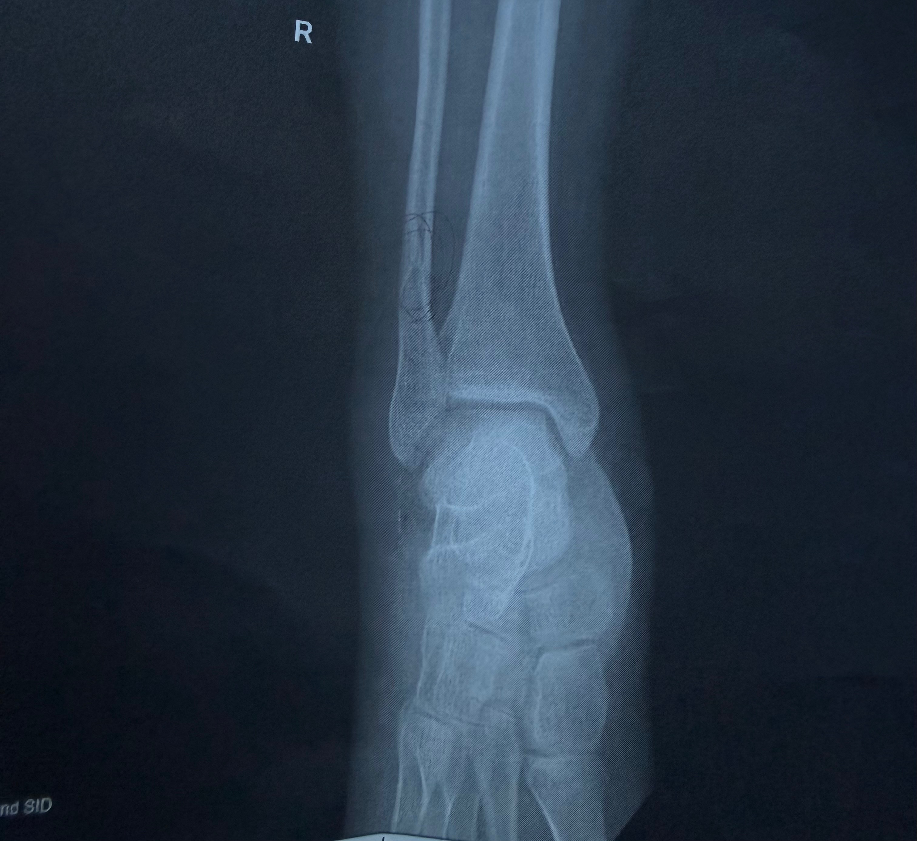 Support Britnee’s Healing Journey After Surgery campaign photo, 6 of 8