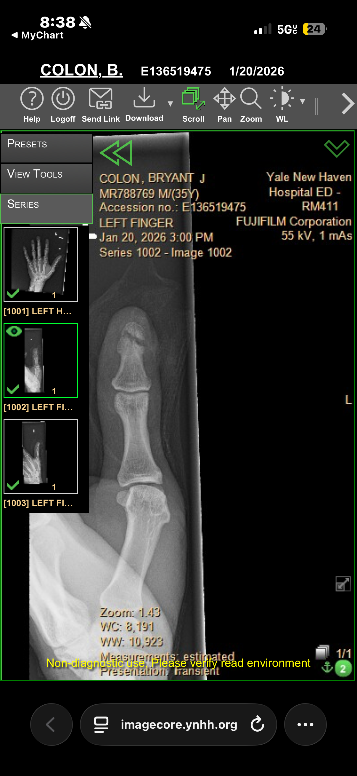 Help Bryant's Family During His Healing campaign photo, 2 of 3