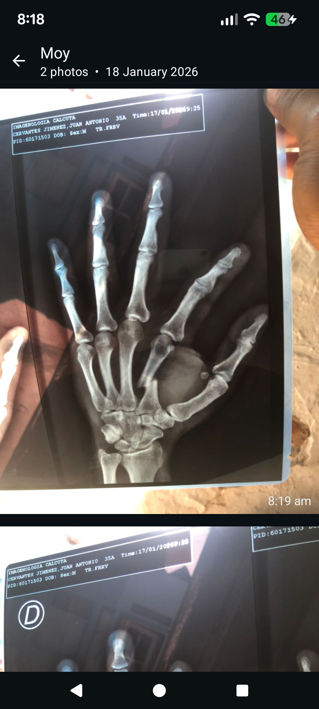Help my friend get the medical help he needs campaign photo, 2 of 5
