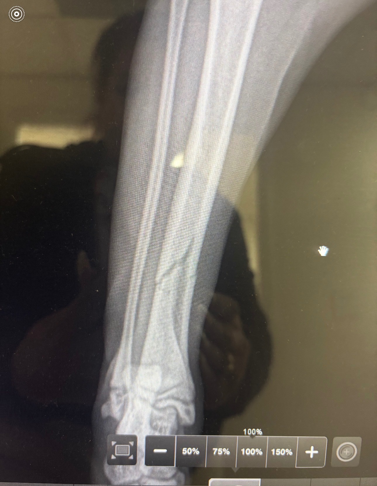 Help my little sister pay for her kittens broken leg. campaign photo, 2 of 7