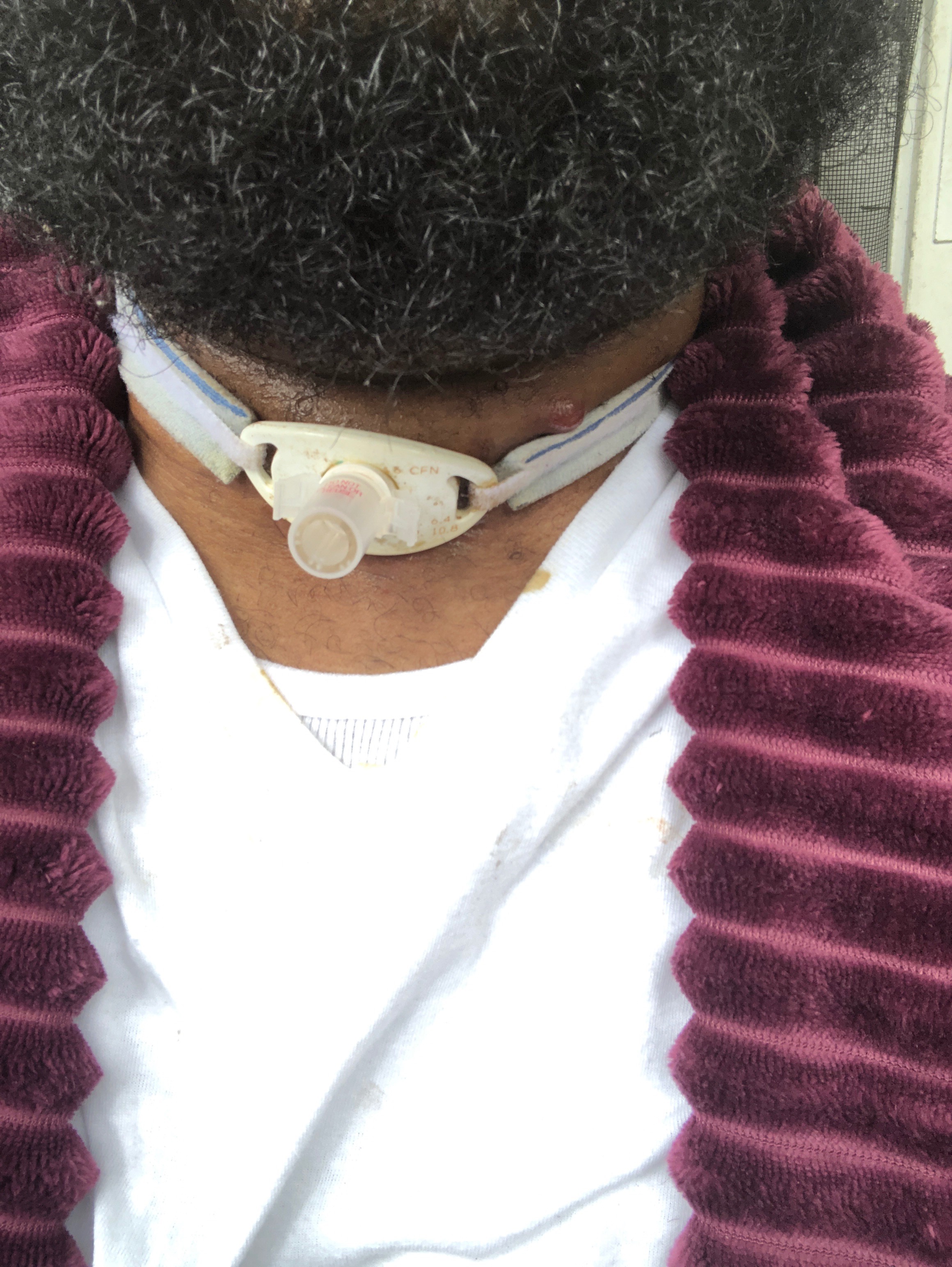 Support for My Stage 4 Thyroid Cancer  Battle & help med campaign photo, 7 of 8