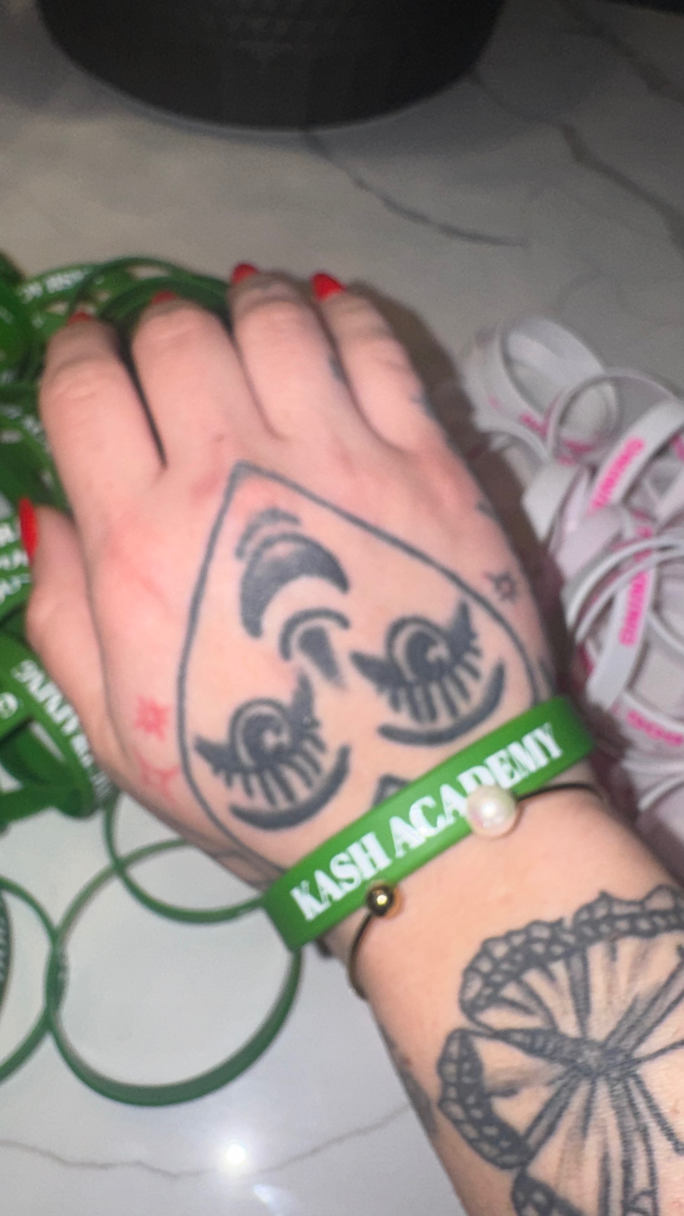 Bracelet Fund for Nigel & his Pups Recovery campaign photo, 7 of 8