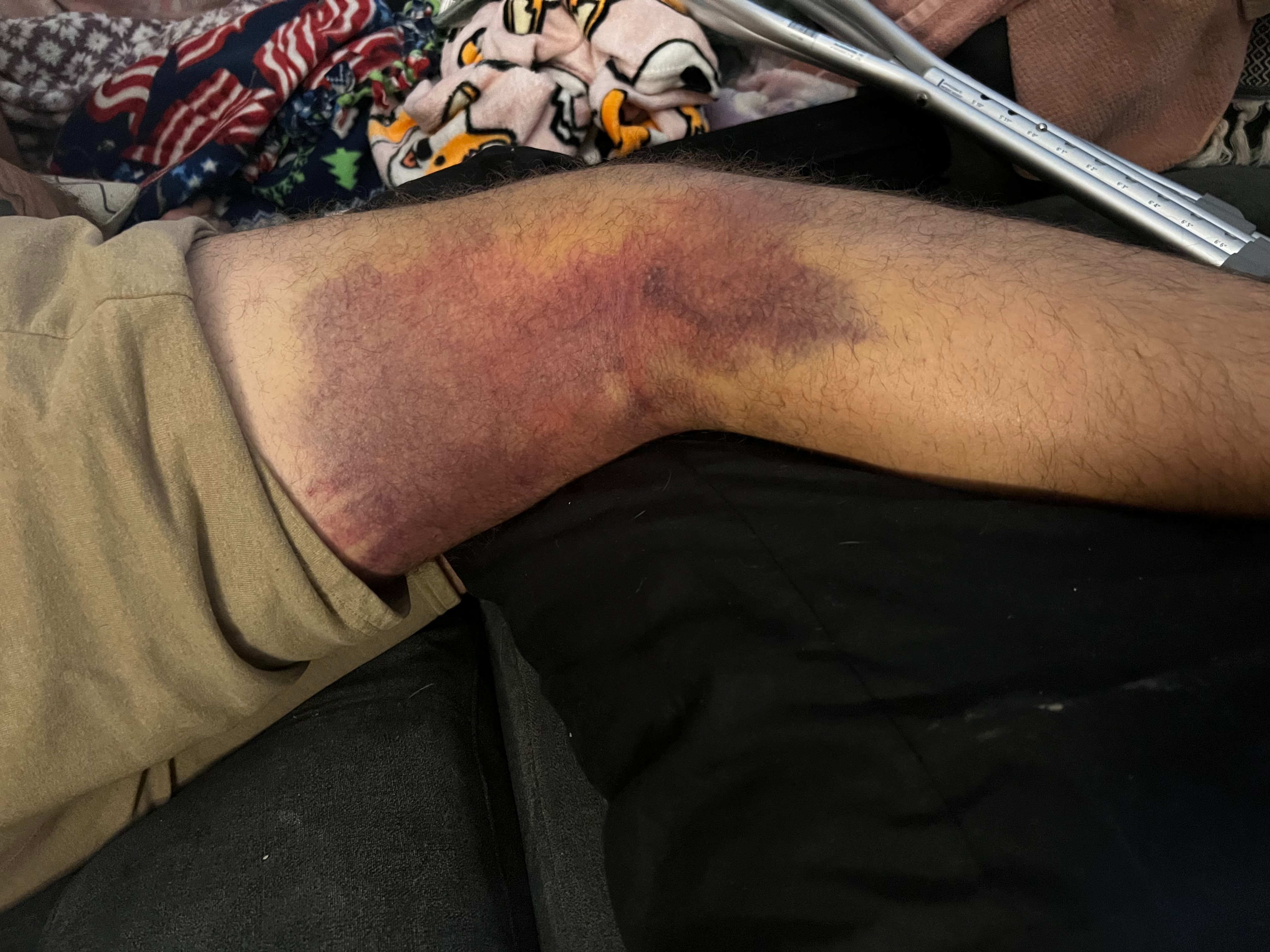 Helping the Rondorf Family: Chase’s Road to Recovery campaign photo, 2 of 8