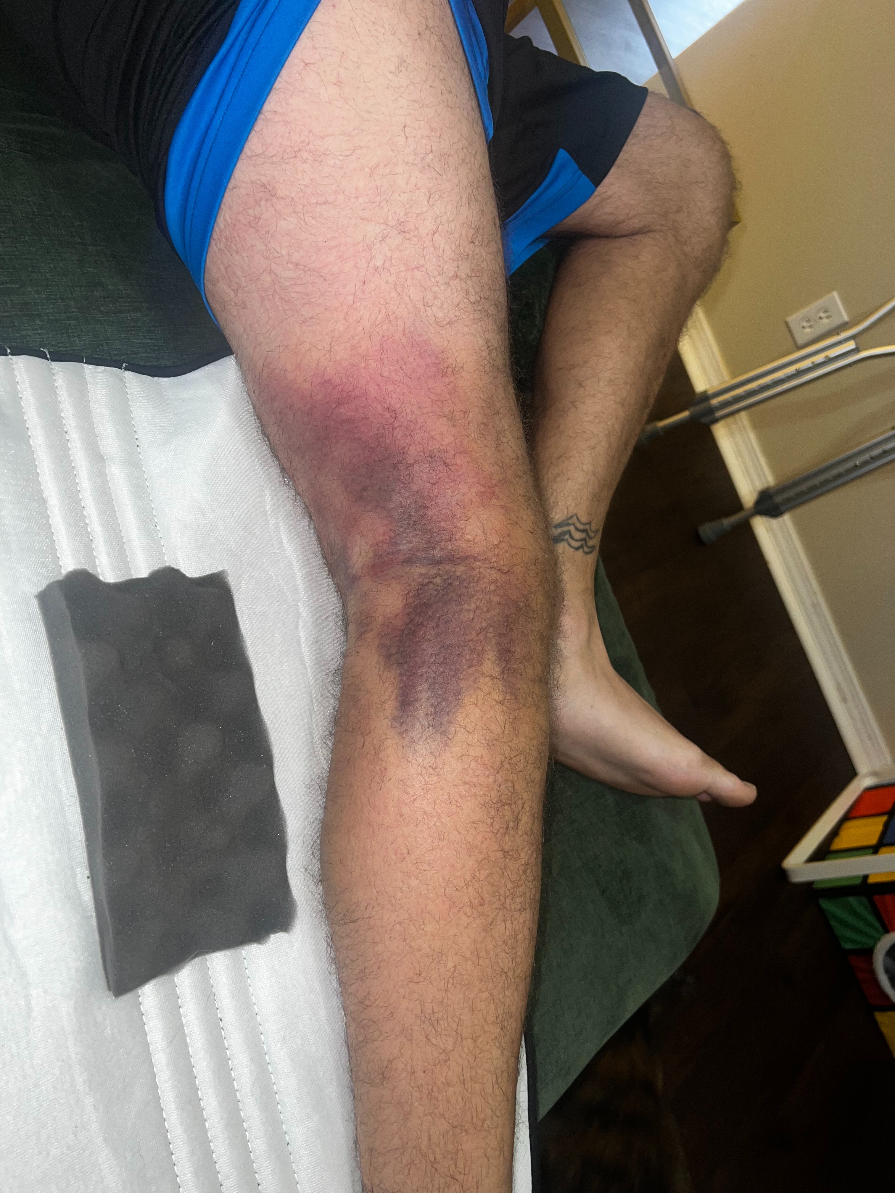 Helping the Rondorf Family: Chase’s Road to Recovery campaign photo, 6 of 8