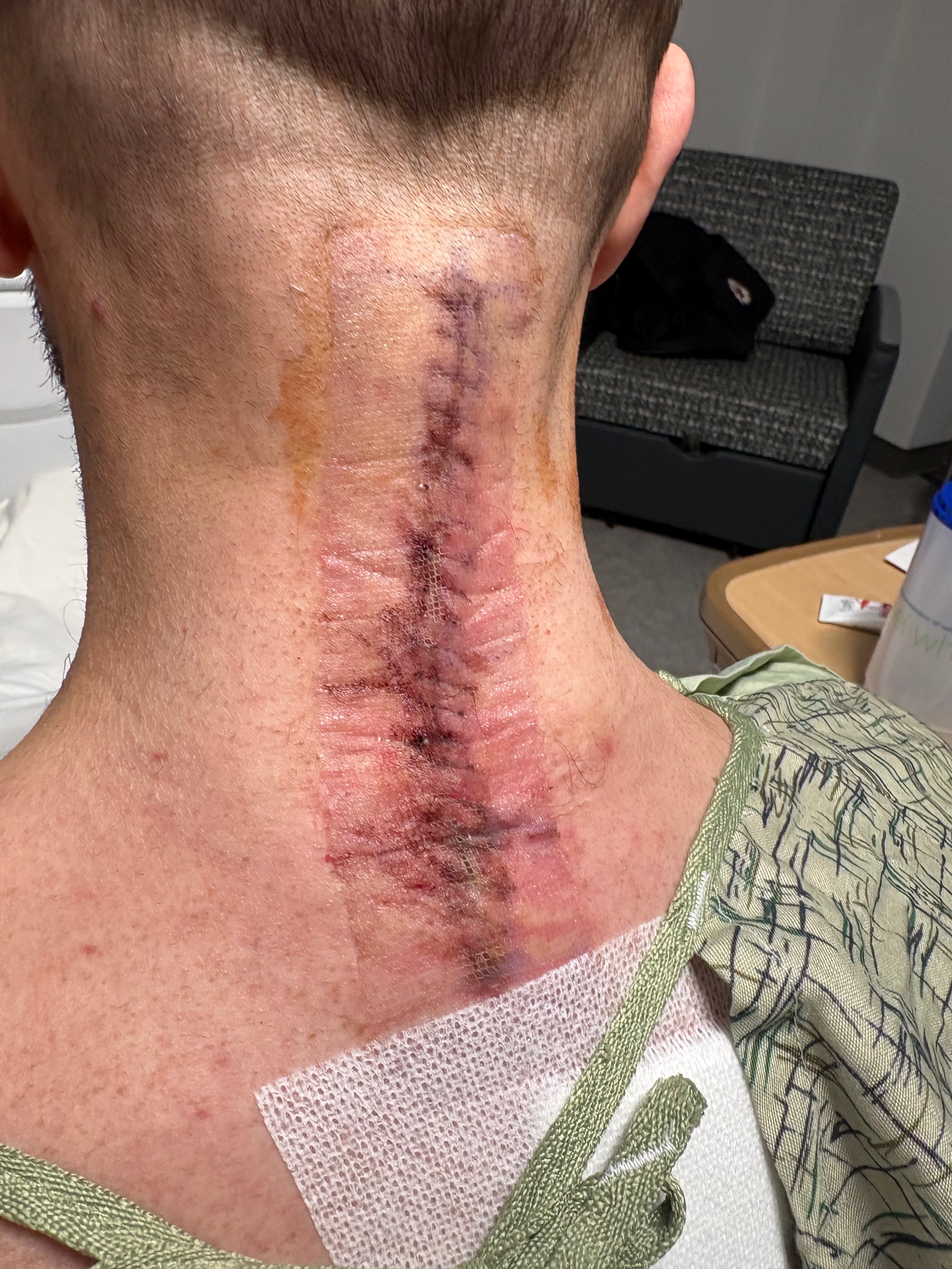 Support Robert’s Recovery After Spinal Injury campaign photo, 5 of 6