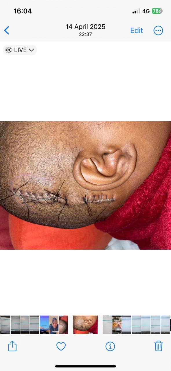 Help Nokukhanya Get Life-Saving Surgery campaign photo, 4 of 8
