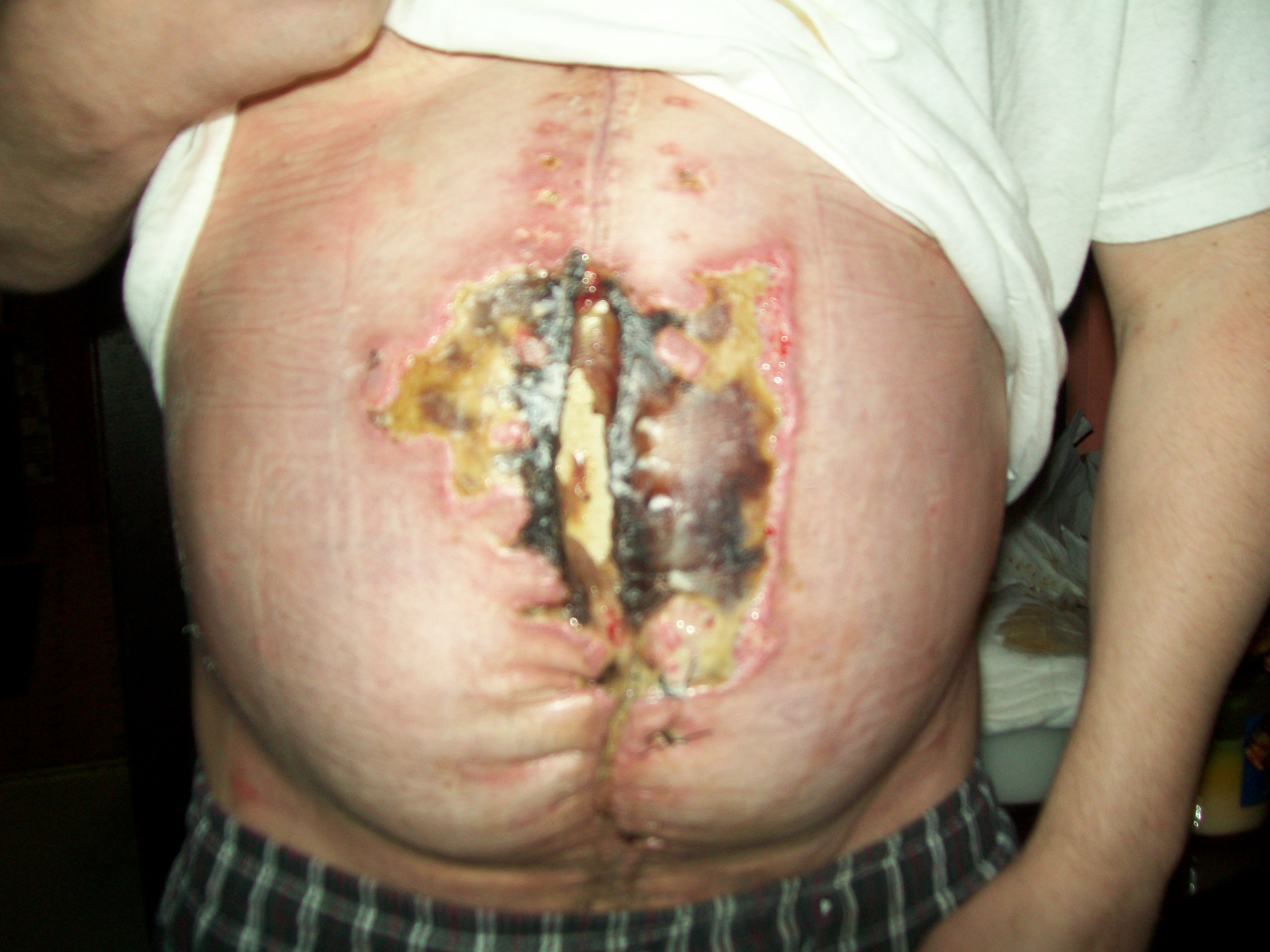 Help Me Spread My Testimony of Second Chances campaign photo, 5 of 8