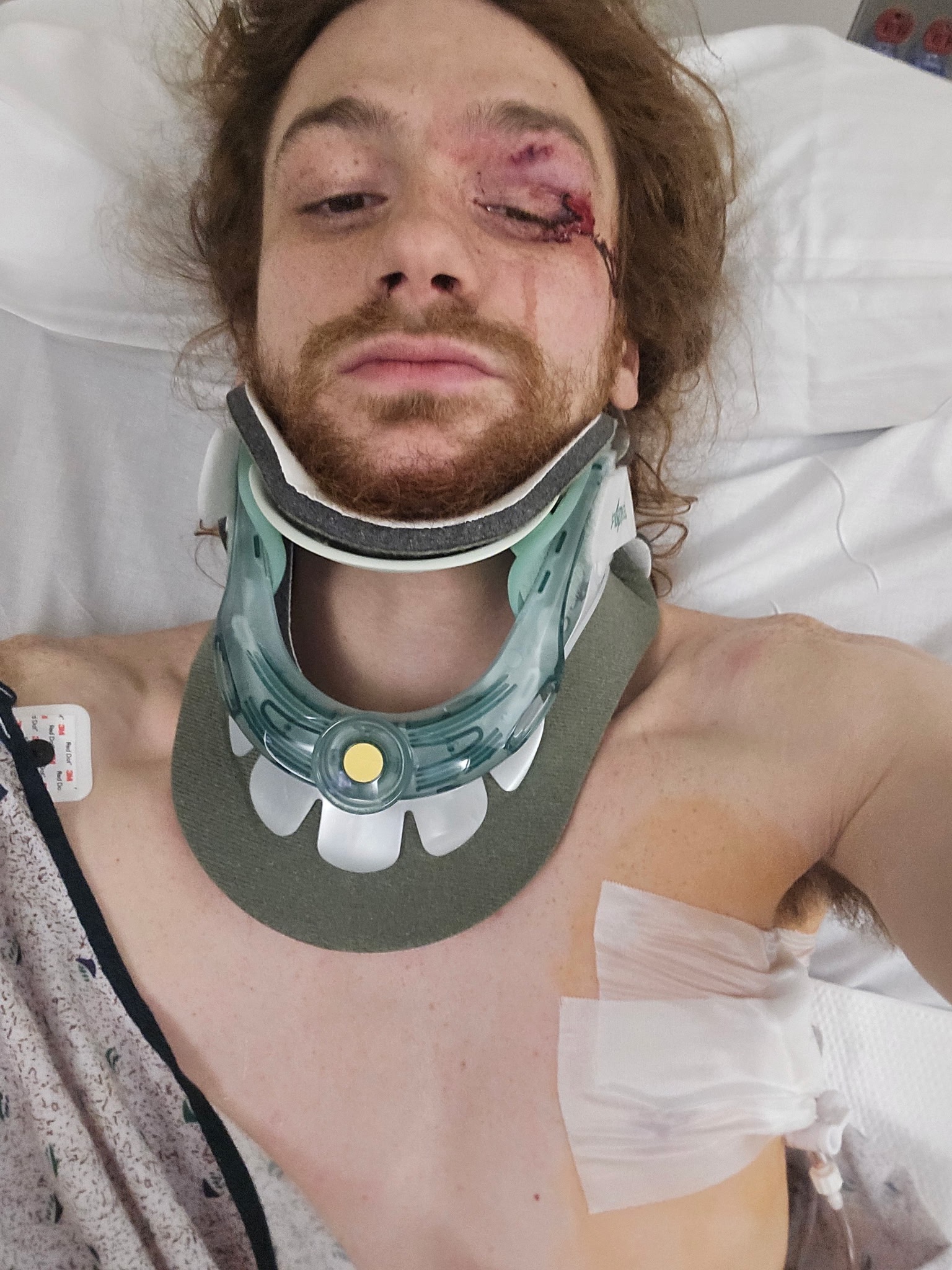Support Michael’s Recovery After the Accident campaign photo, 2 of 4