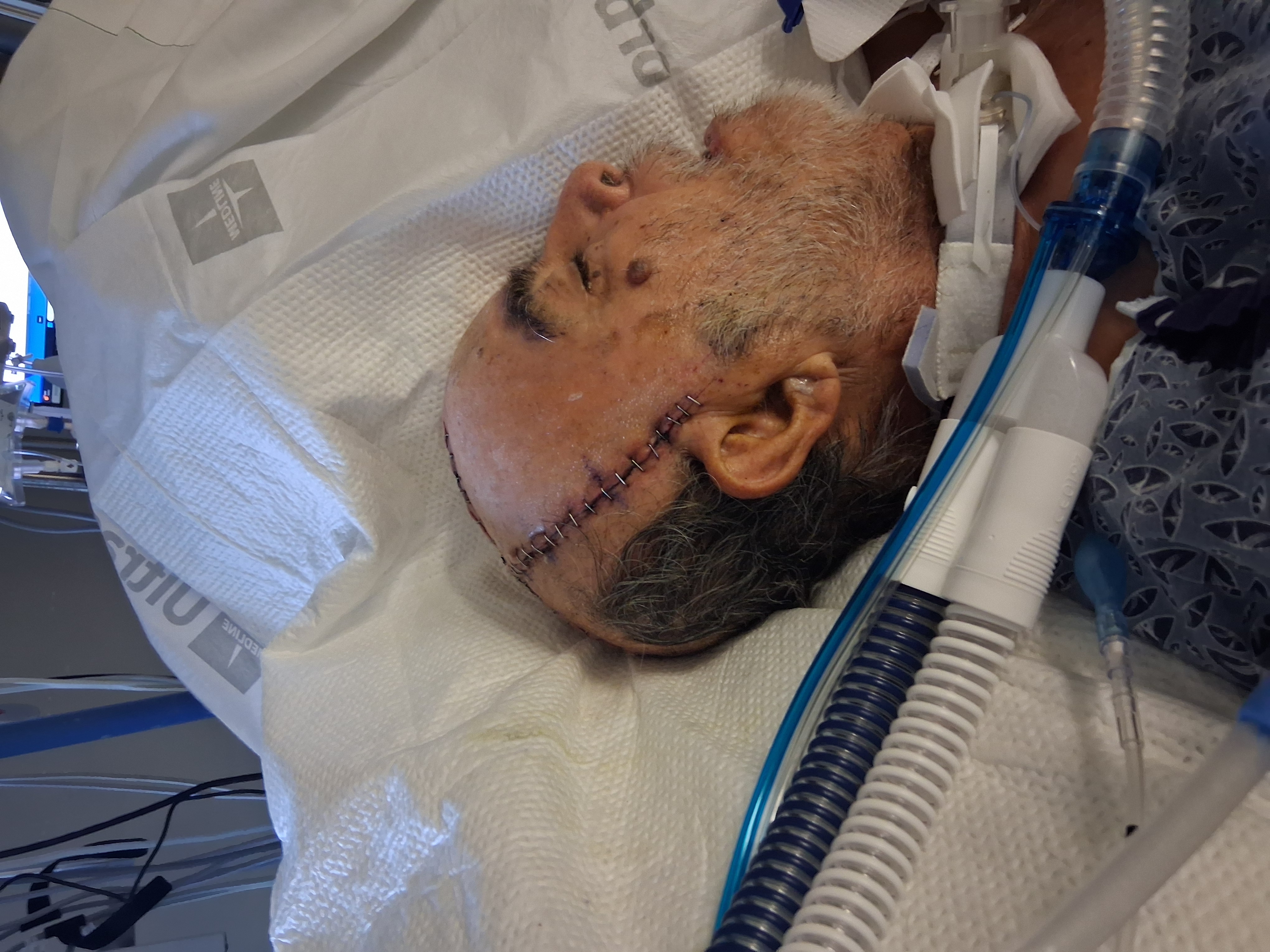Help Arnulfo Heal After Hit-and-Run Incident campaign photo, 2 of 11