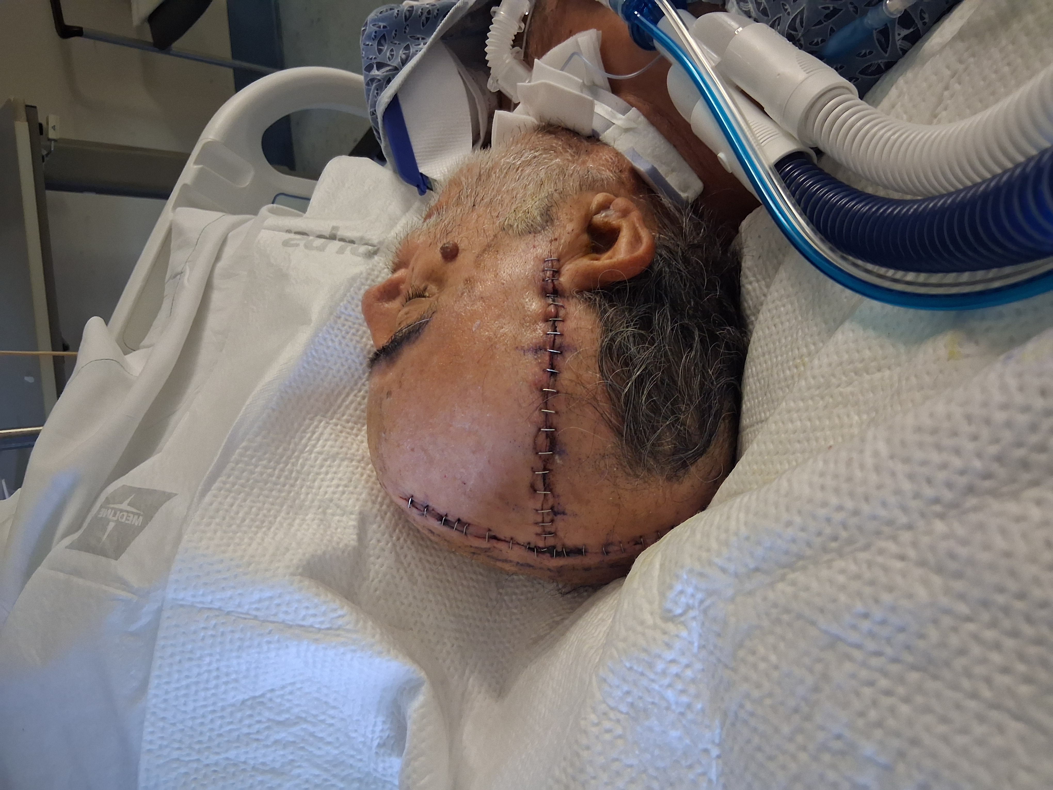 Help Arnulfo Heal After Hit-and-Run Incident campaign photo, 4 of 11