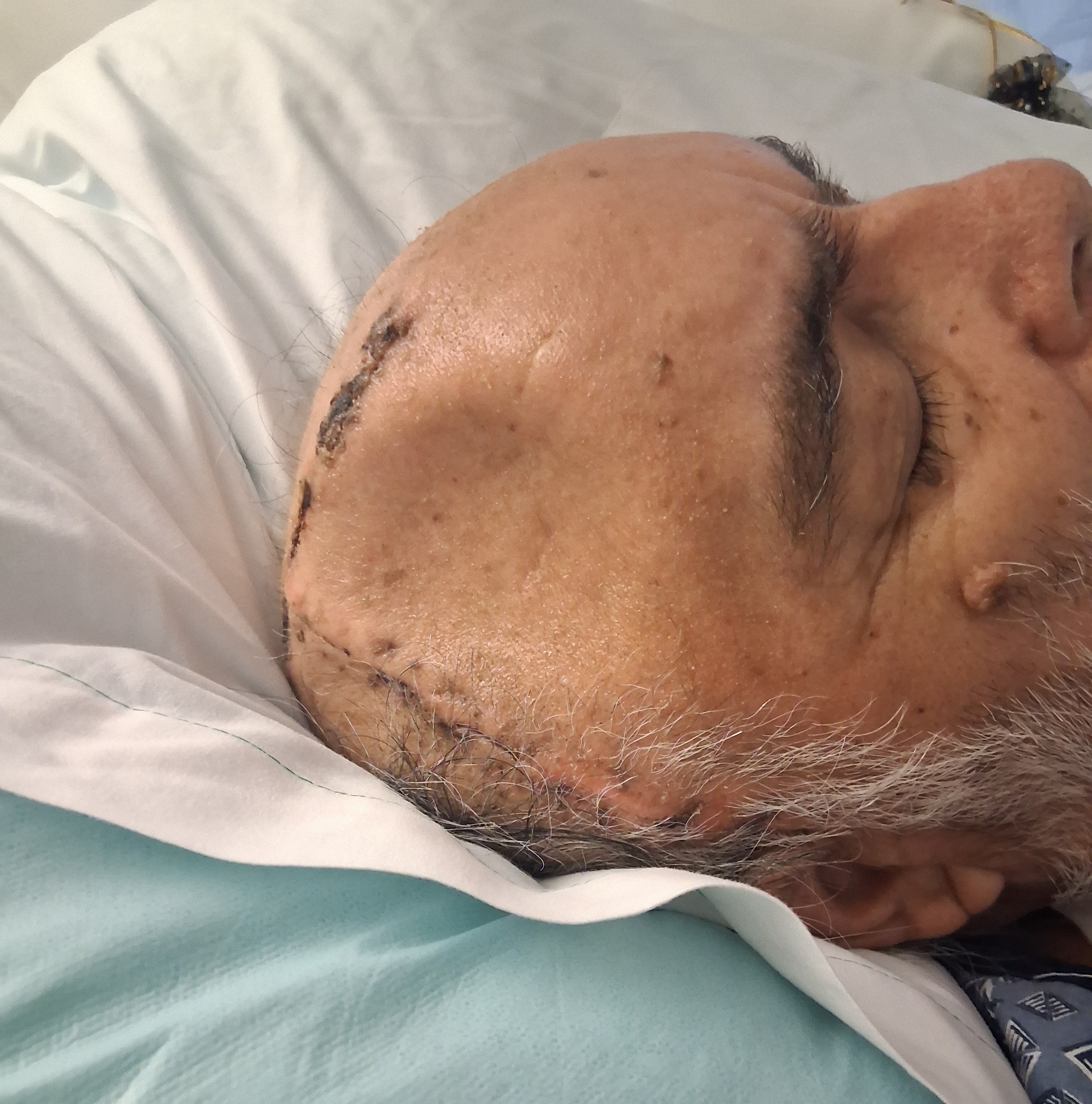 Help Arnulfo Heal After Hit-and-Run Incident campaign photo, 5 of 11