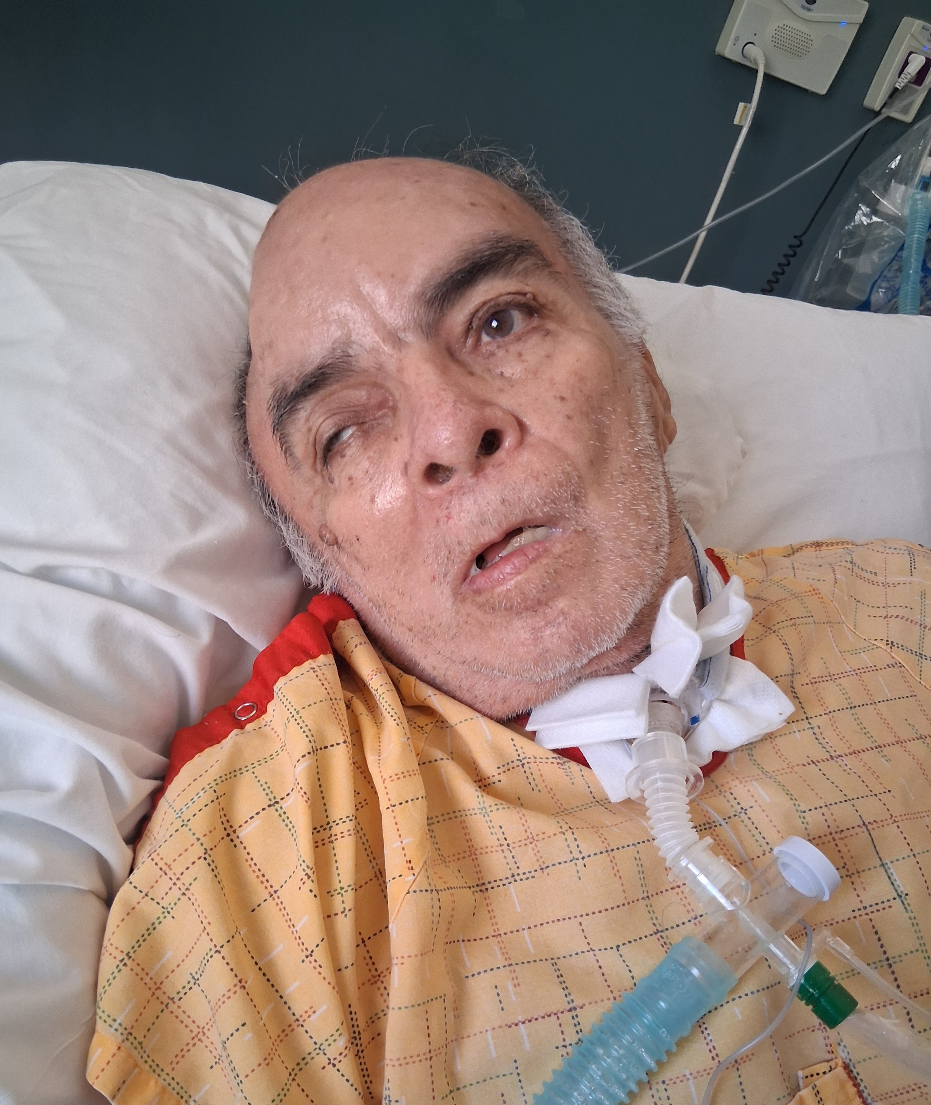 Help Arnulfo Heal After Hit-and-Run Incident campaign photo, 6 of 11