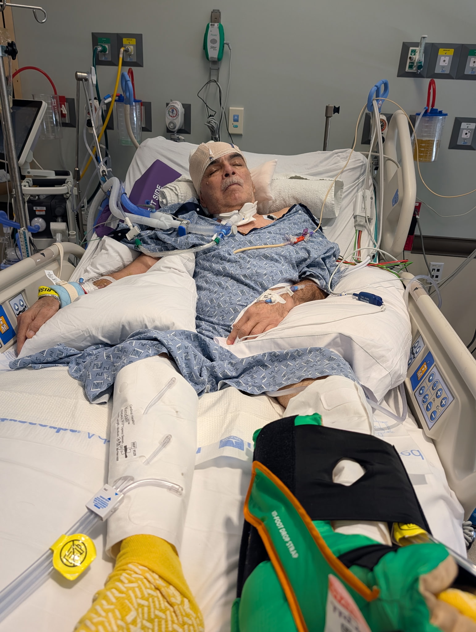 Help Arnulfo Heal After Hit-and-Run Incident campaign photo, 8 of 11