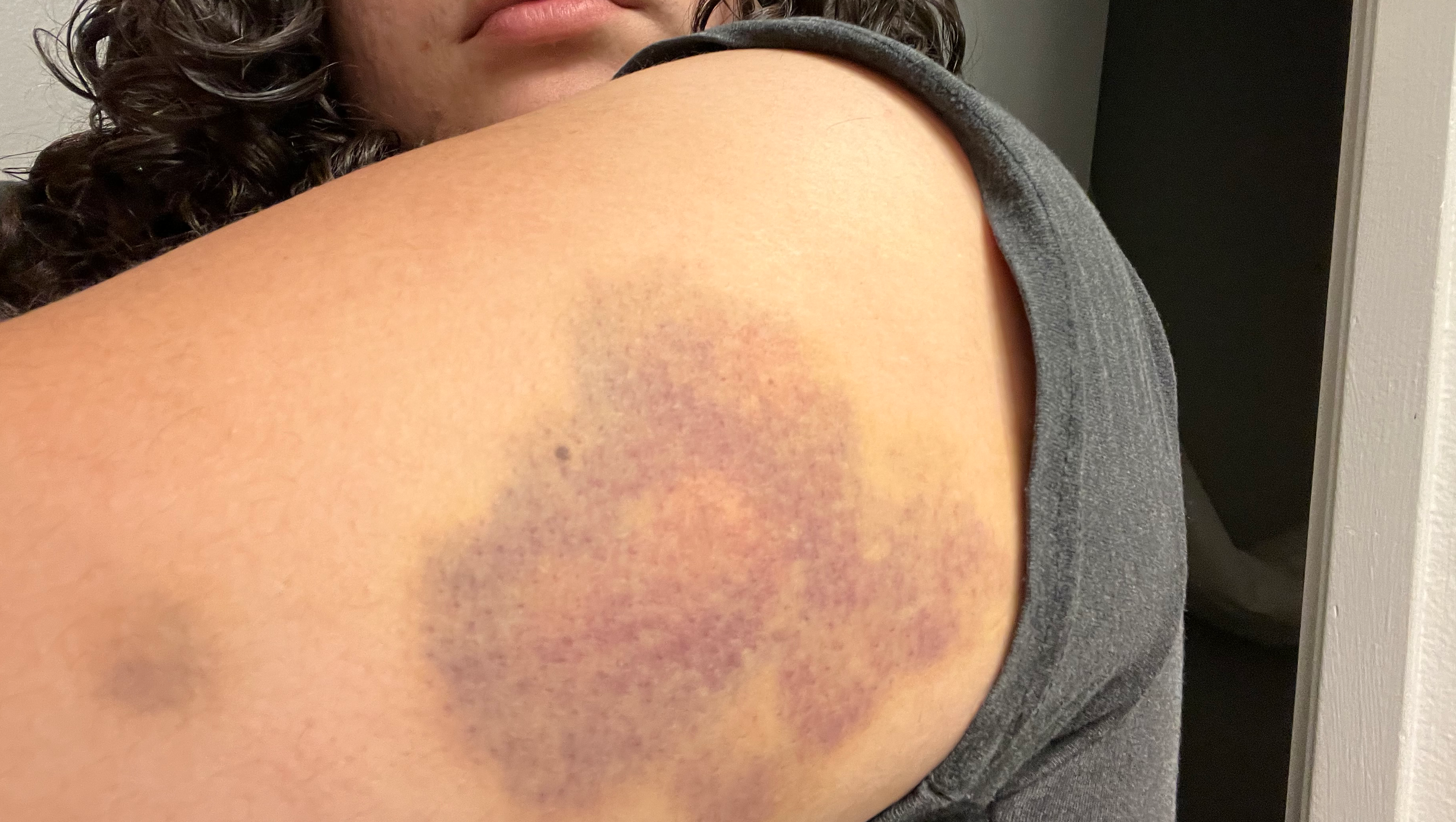 Support Edith's New Start After Domestic Abuse photo