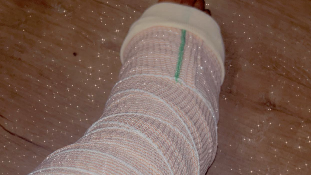 Support Felicia After Her Ankle Injury photo
