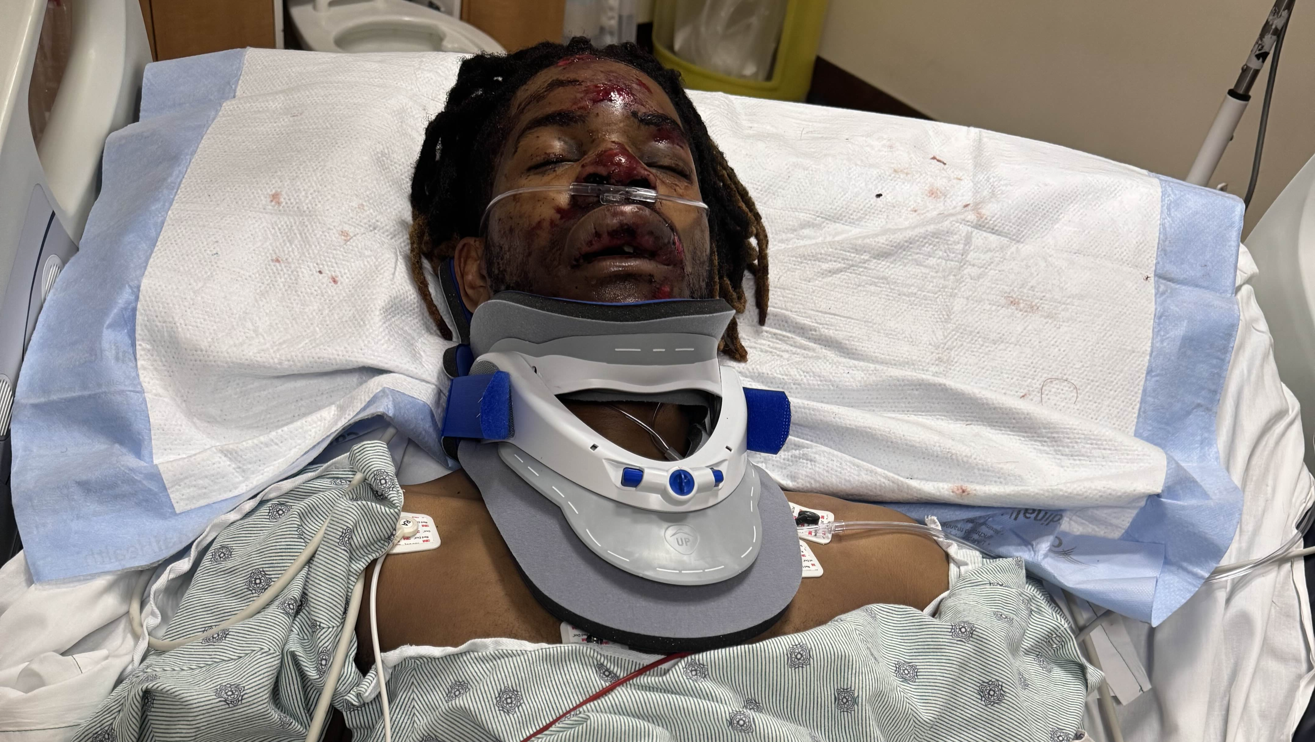 Healing After a Hit-and-Run Accident