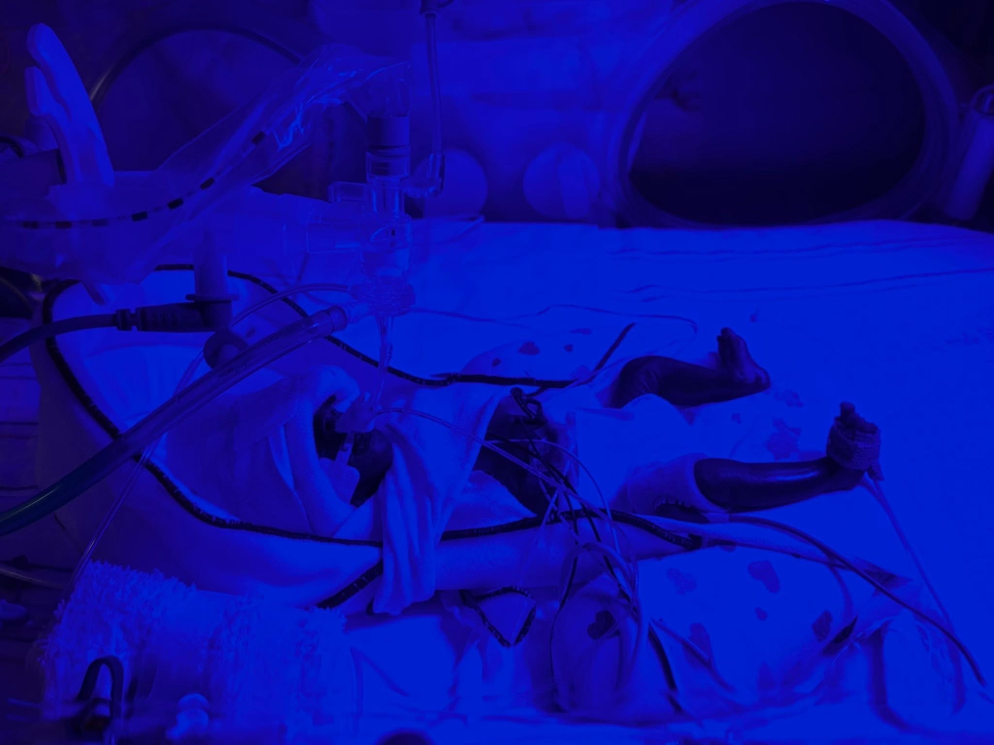 Support Baby Heartlynn's Fight in the NICU campaign photo, 4 of 8