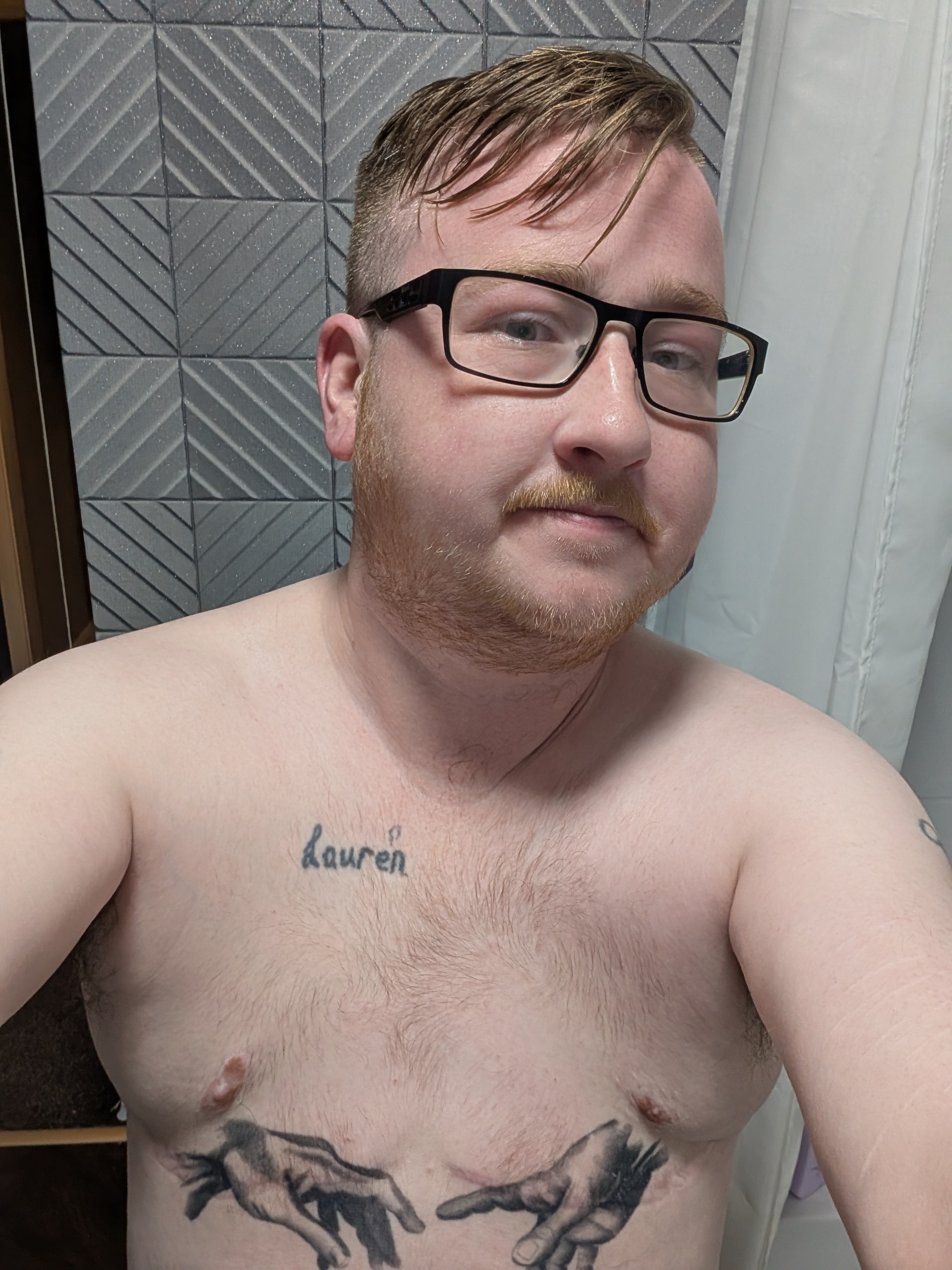 My journey and life and needing Phalloplasty surgery campaign photo, 5 of 8
