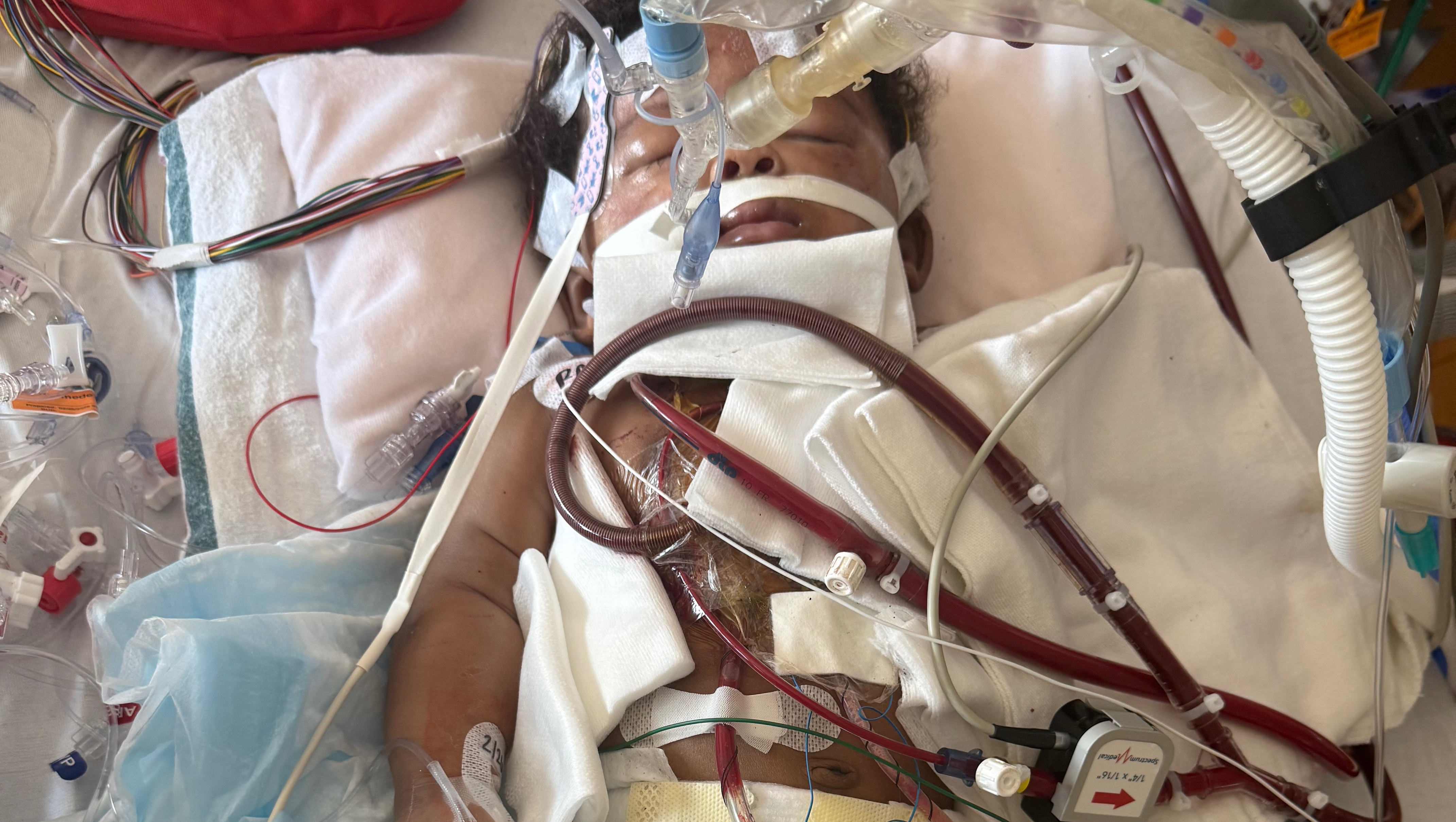 Ezekiel's New Heart & Resilience Overcoming Heart Surgery’s photo