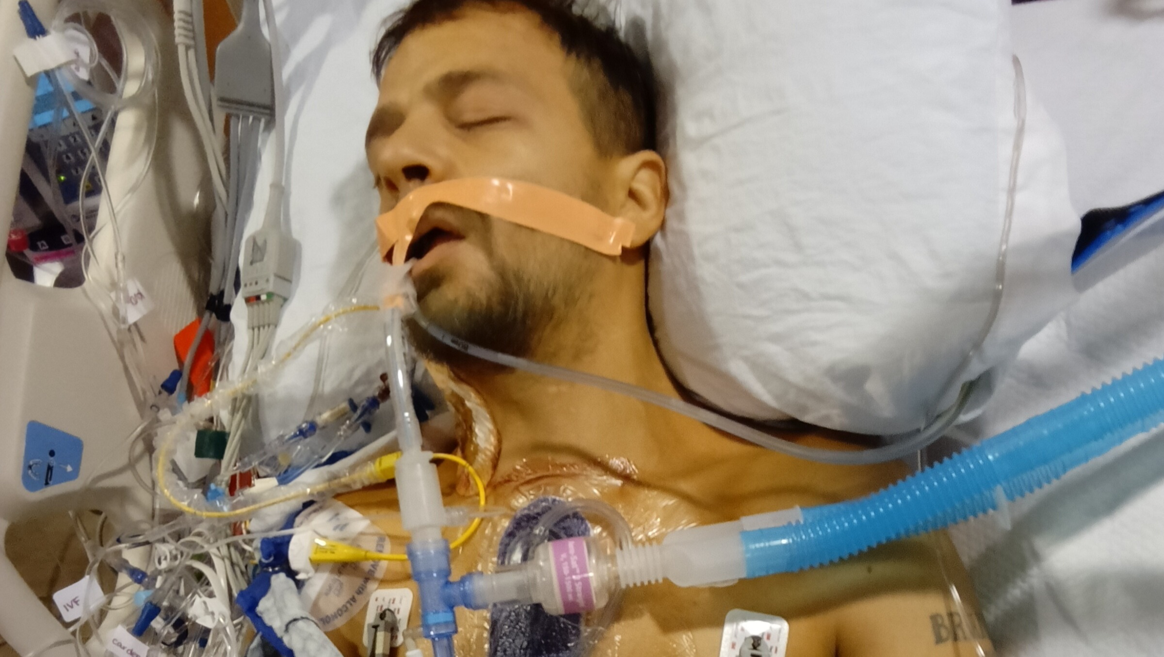 Help Edward & Fiancé Rebuild After Surgery photo