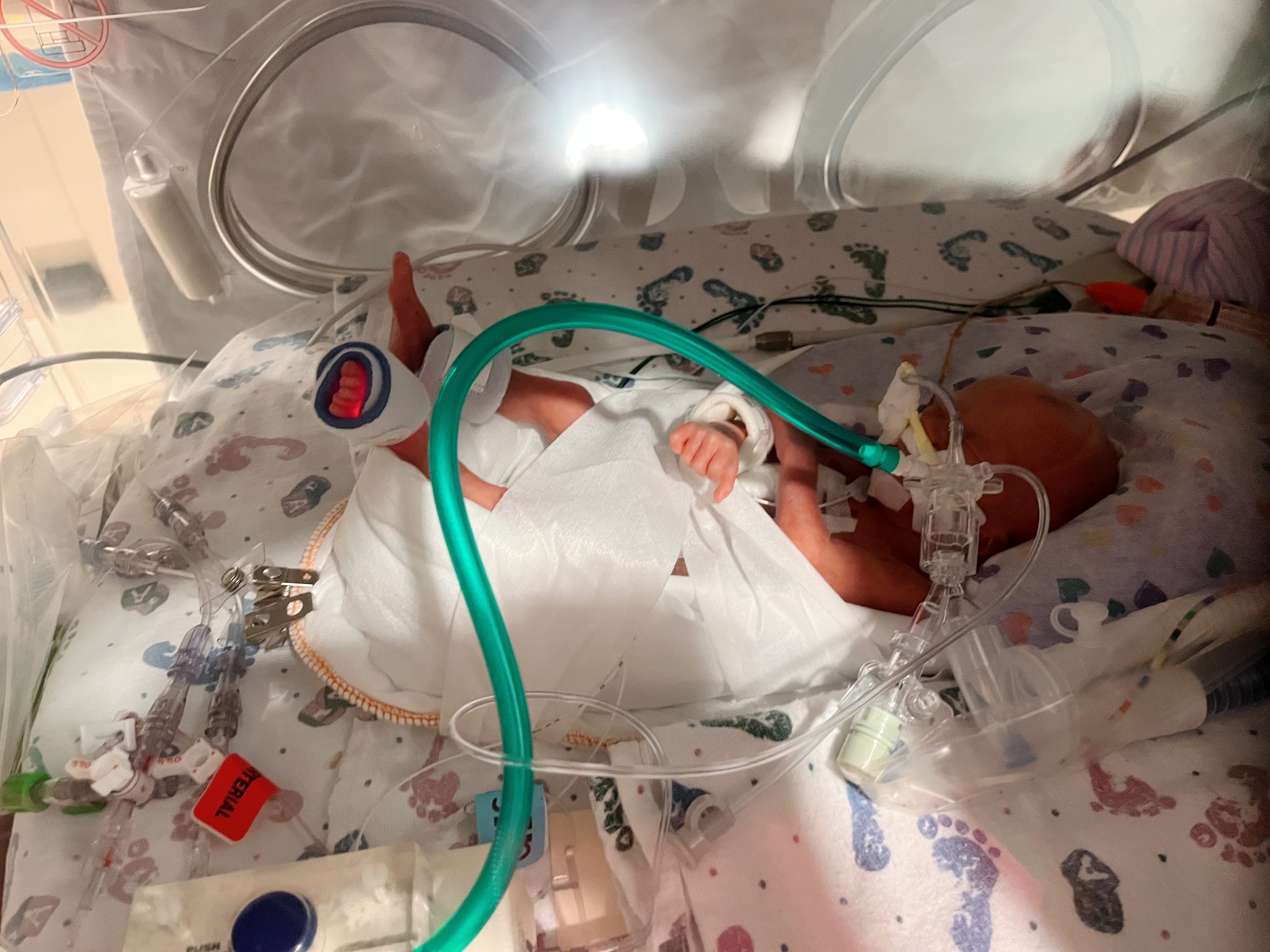Tiny but Mighty: Support Baby Leonardo Chudo’s NICU Journey campaign photo, 5 of 8