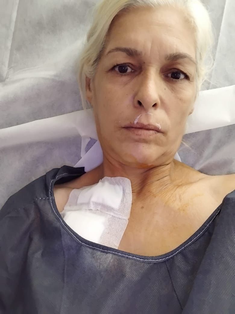 Urgent Help for My Mom Fighting Cancer Alone campaign photo, 2 of 8