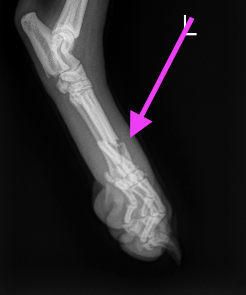 Help Nova Heal: Support her Surgery Costs campaign photo, 5 of 6