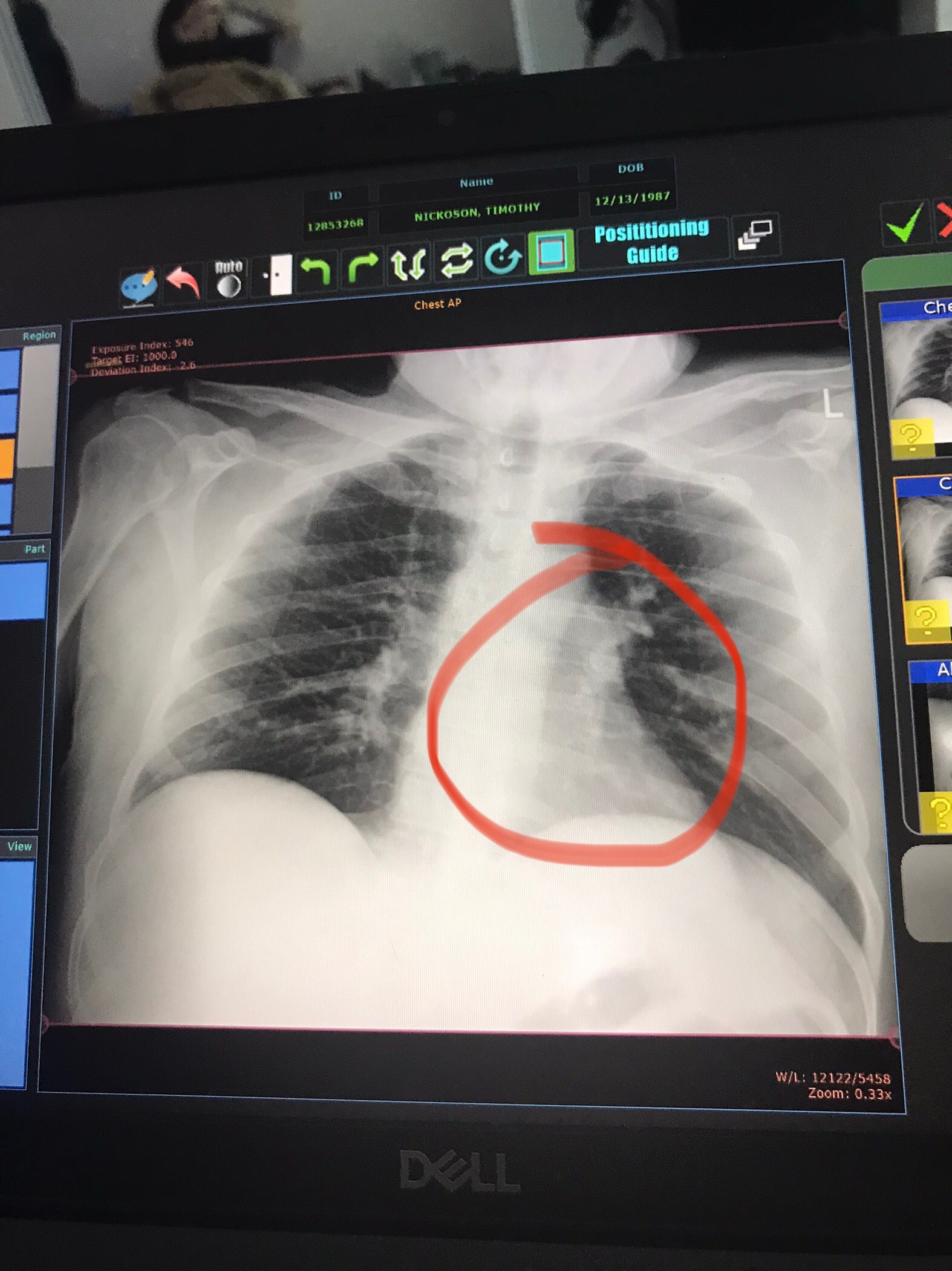 Help Timothy Recover After Motorcycle Accident campaign photo, 2 of 8